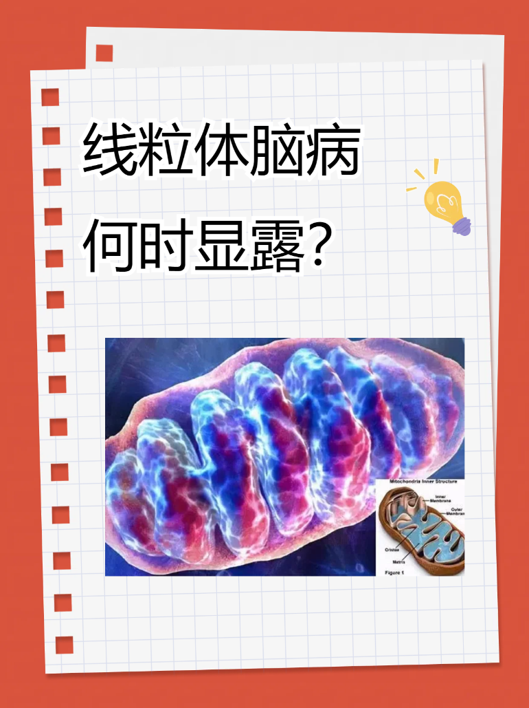 线粒体脑病何时显露?