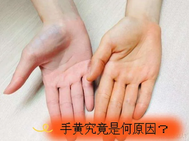 手掌变黄的6个可能原因,速来自检