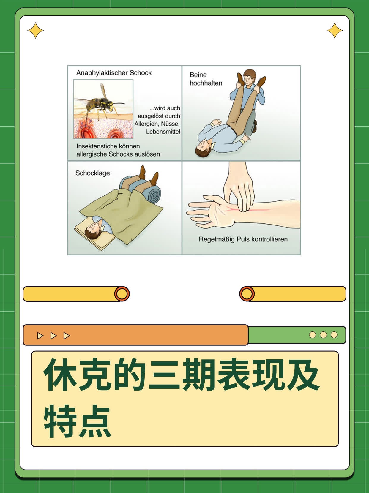 休克的三期表现及特点