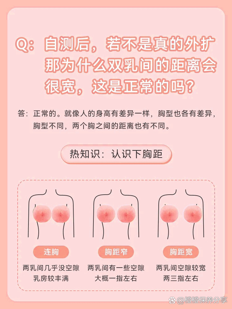 没沟02胸外扩631521566步辨别是否真外扩?