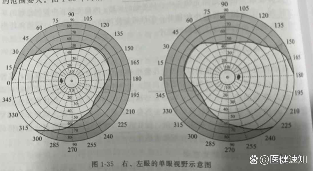 视力检测时候为啥要检查视野呢?