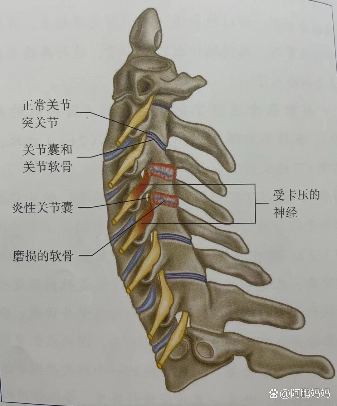 p  关节突关节 br 关节突关节是高度敏感的结构