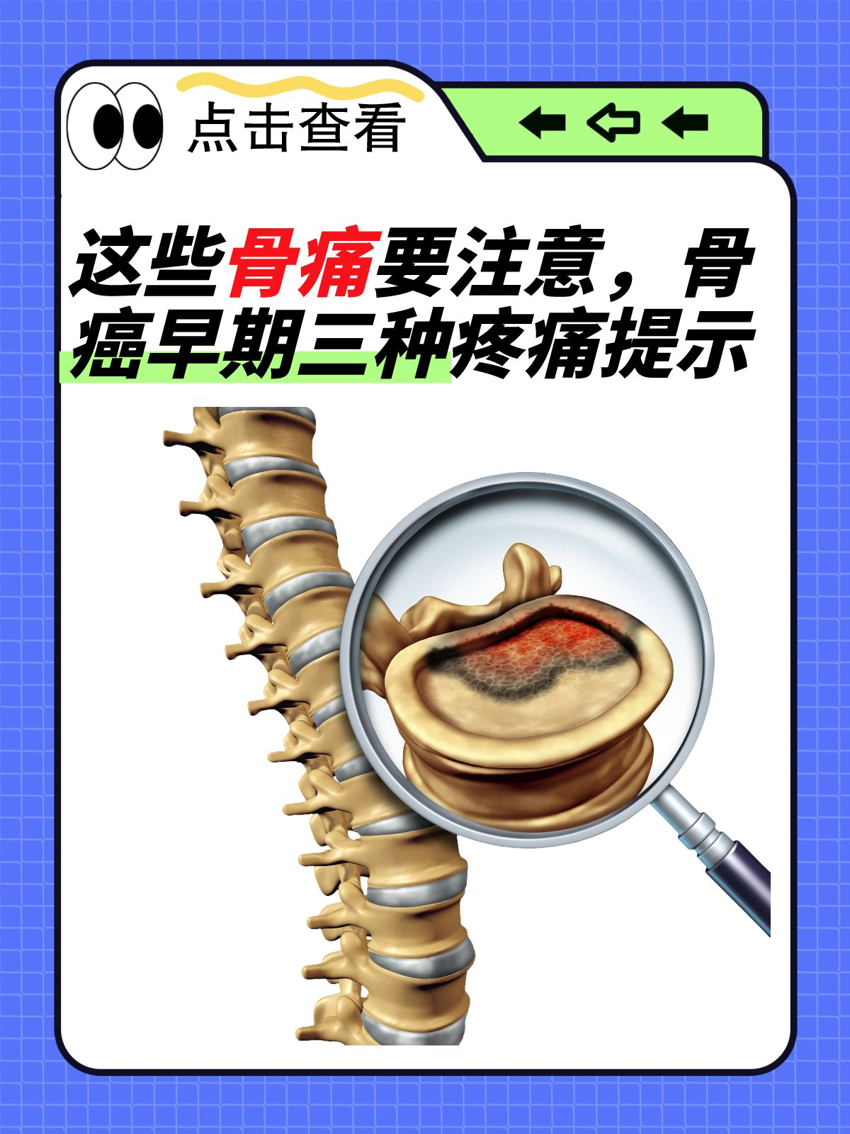 这些骨痛要注意,骨癌早期三种疼痛提示