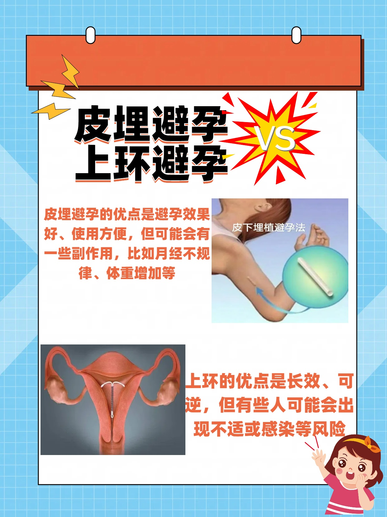 皮埋避孕vs上环:哪个更靠谱?听我这个"避孕达人"给你唠唠!