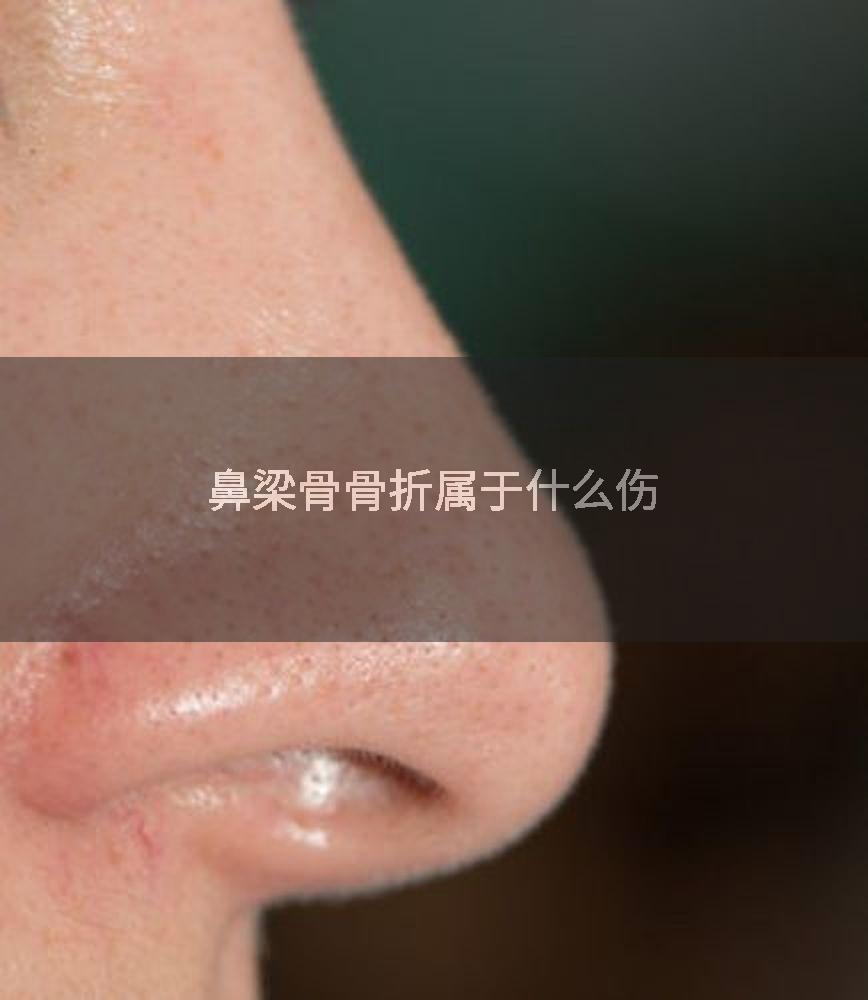鼻梁骨骨折属于什么伤