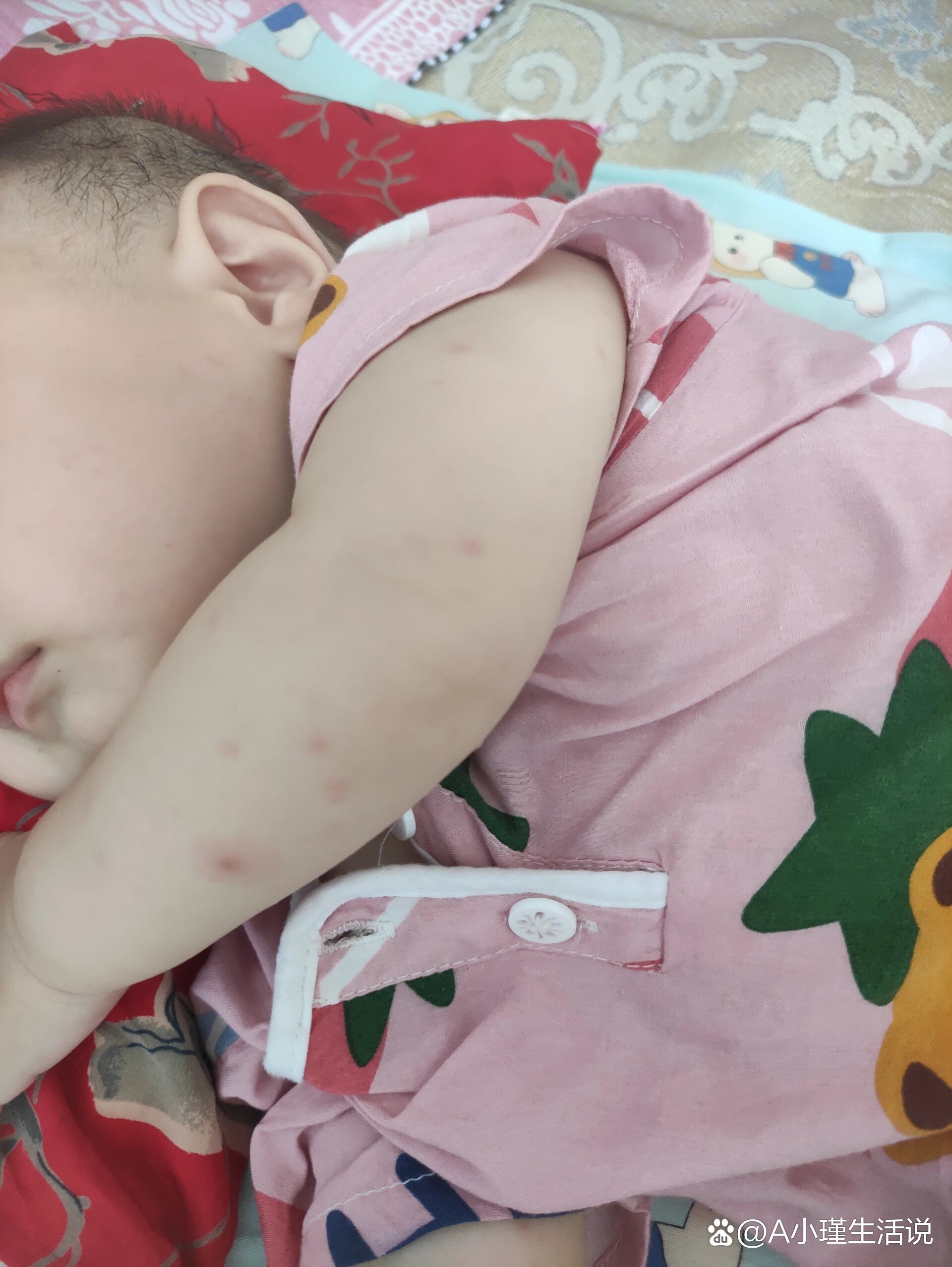 31周一去医院抽血化验,有炎症,医生开了阿奇霉素 鱼腥草 易坦静  br>