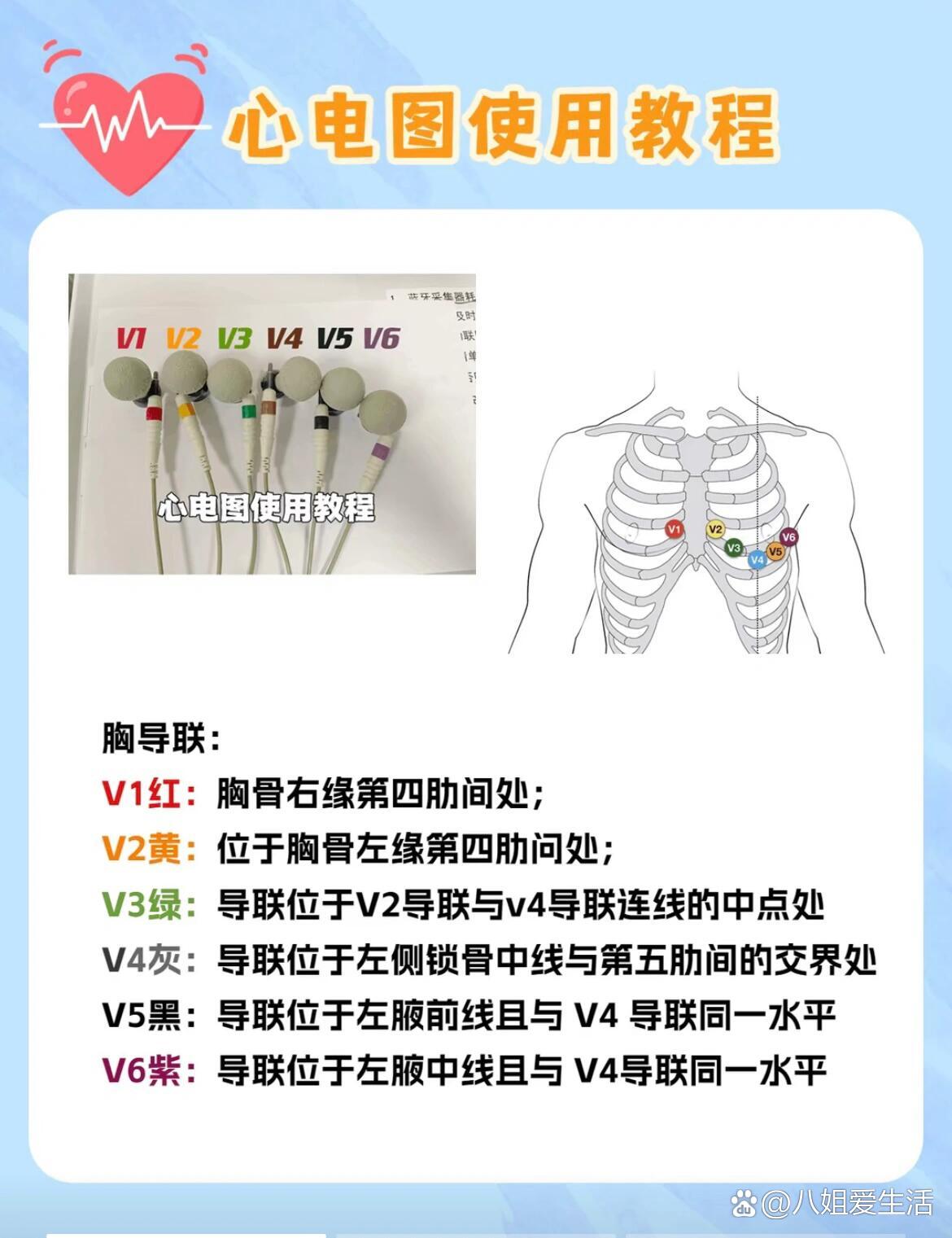 心电图机的使用及图解图片