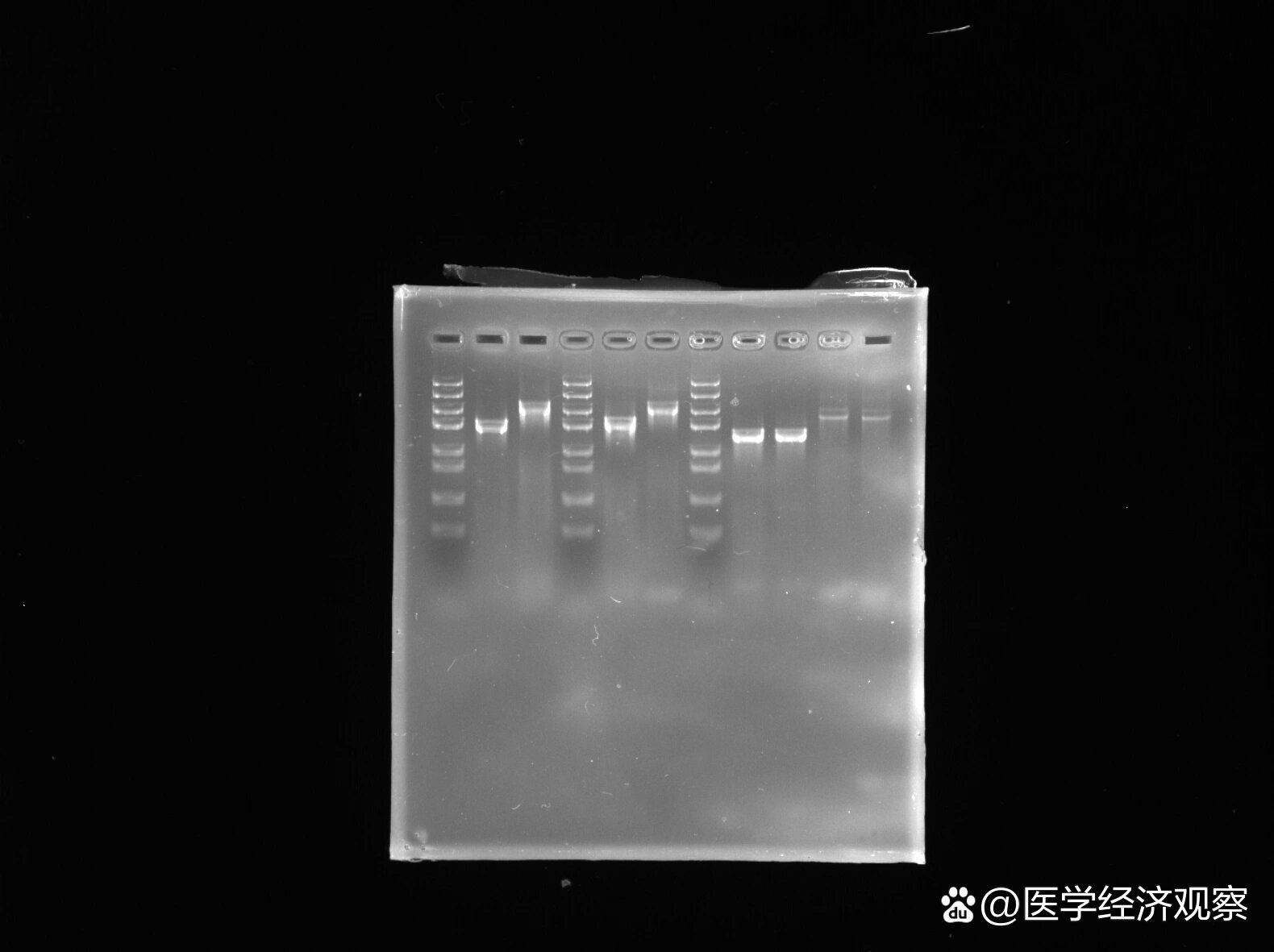 rna降解电泳图图片