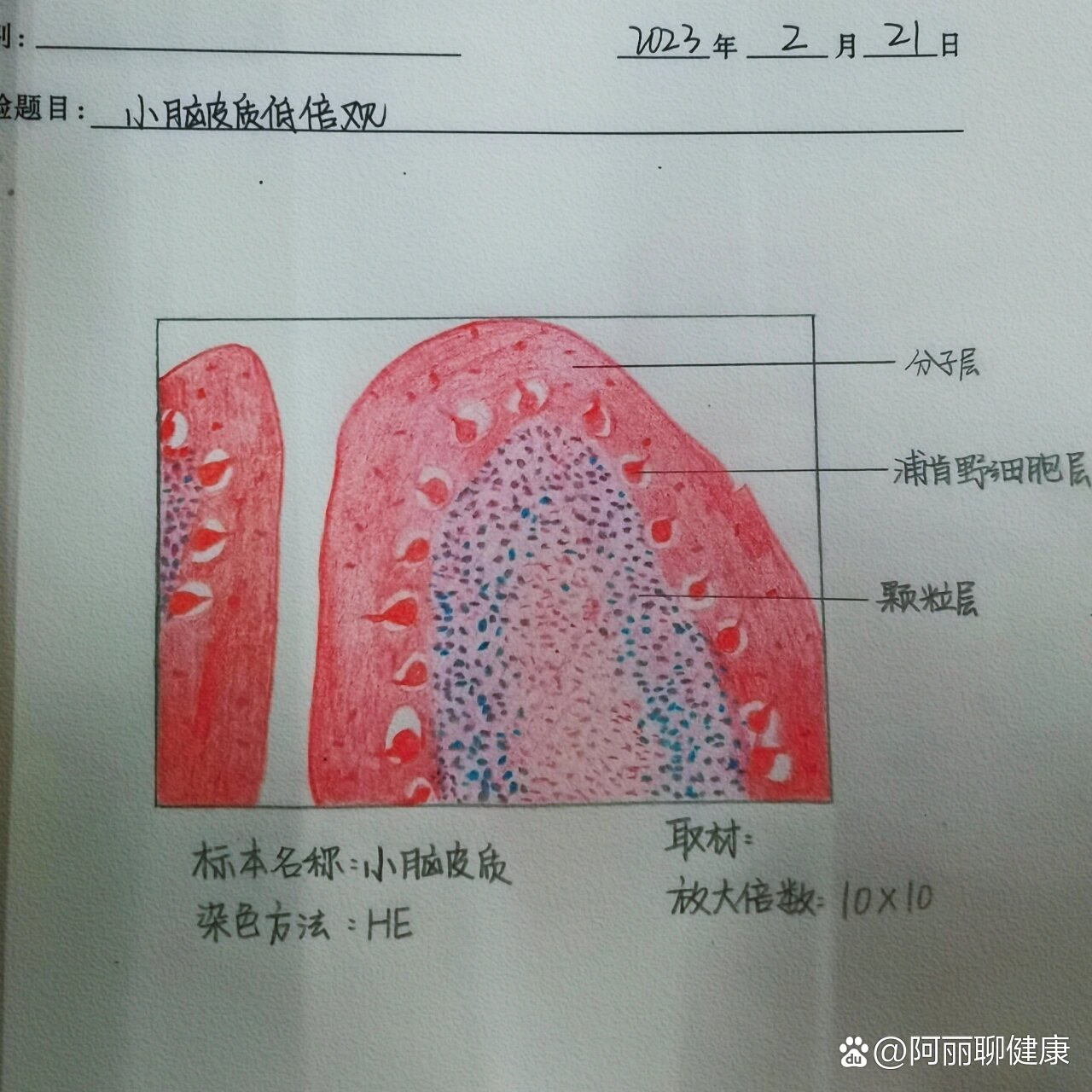 流脑病理红蓝铅笔图图片