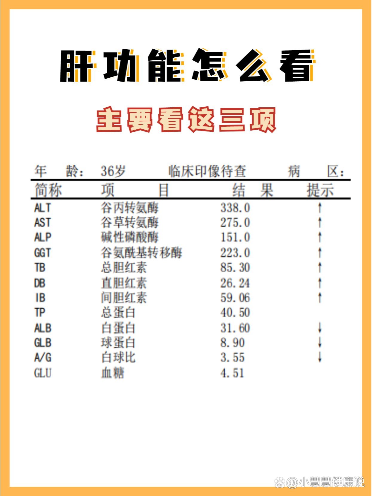 1分钟教你看懂肝功能检查单!