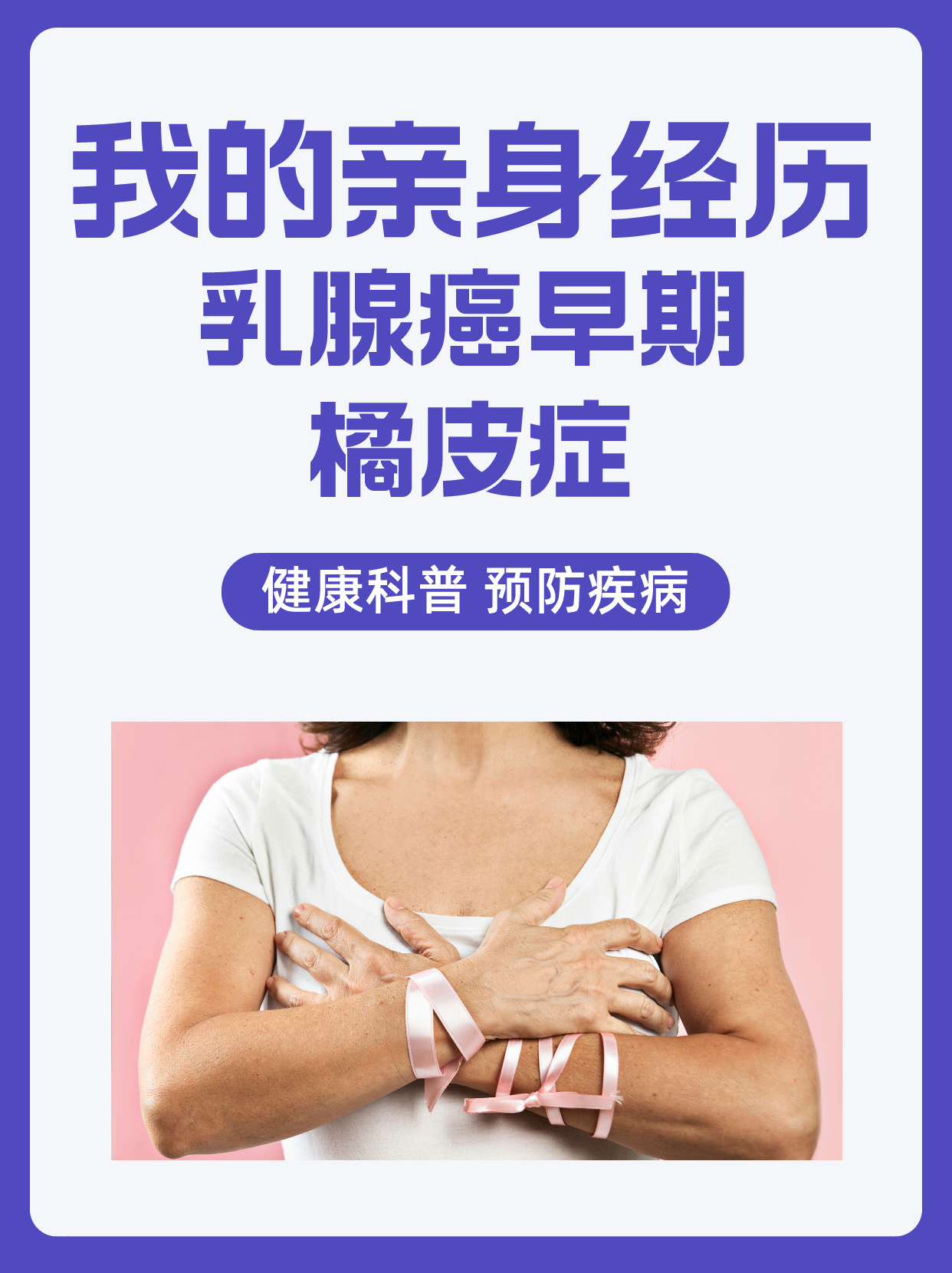 乳腺癌早期症状橘皮图片