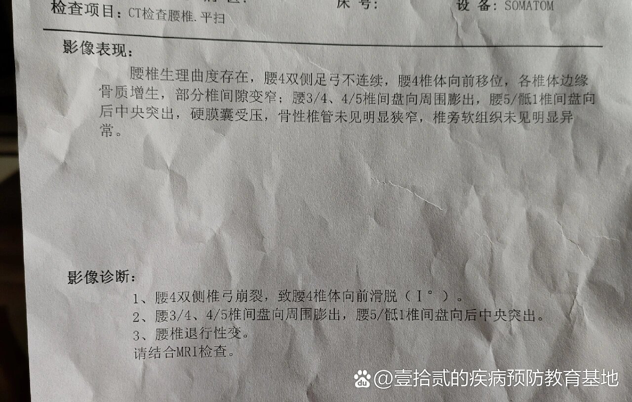 腰椎滑脱报告模板图片