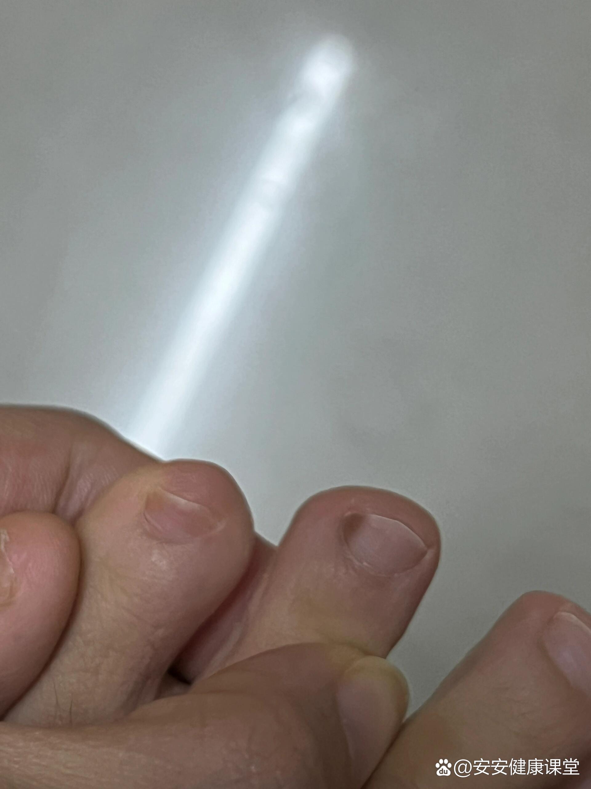 指甲黑了要注意了