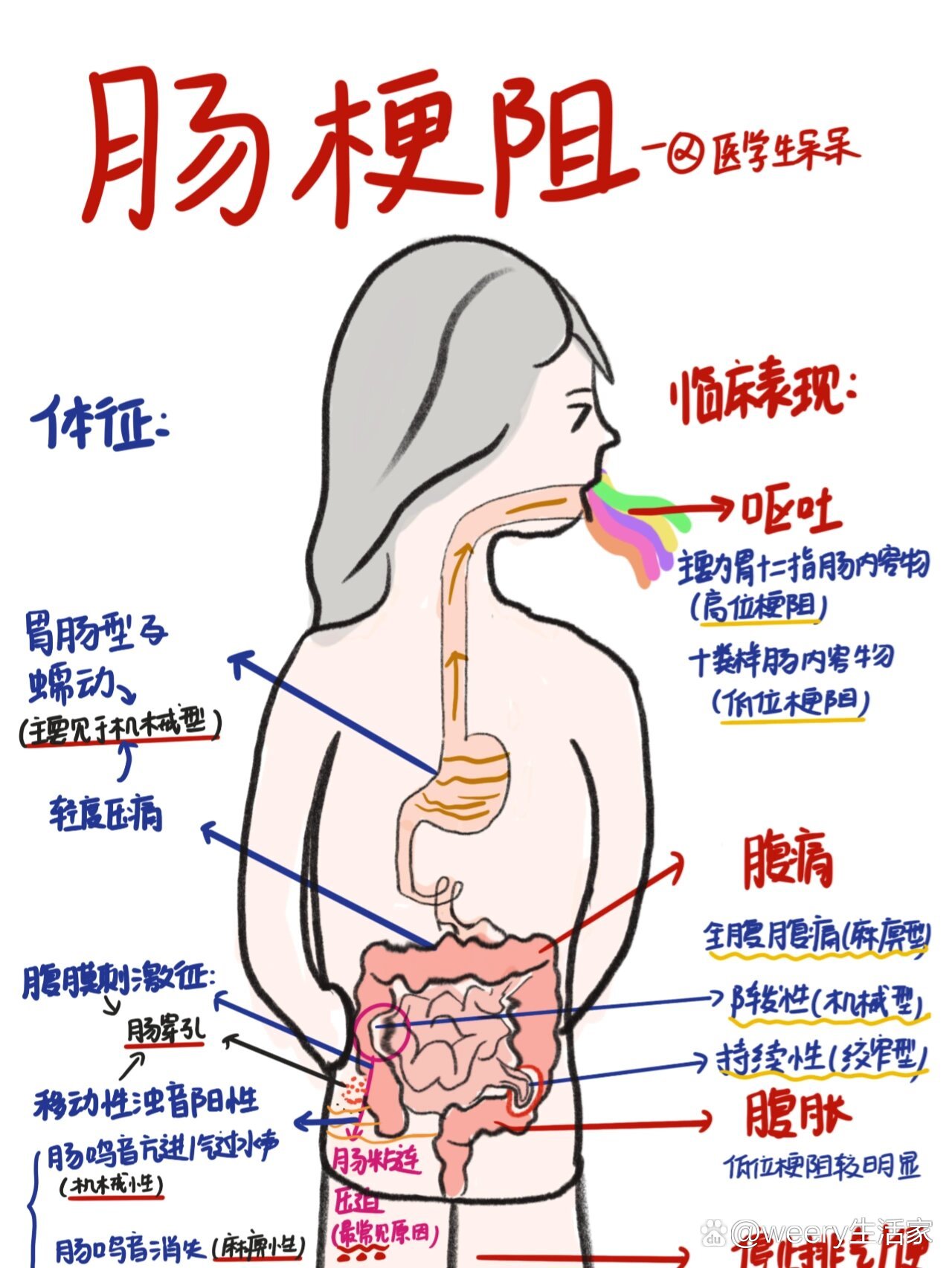 单纯性肠梗阻图片