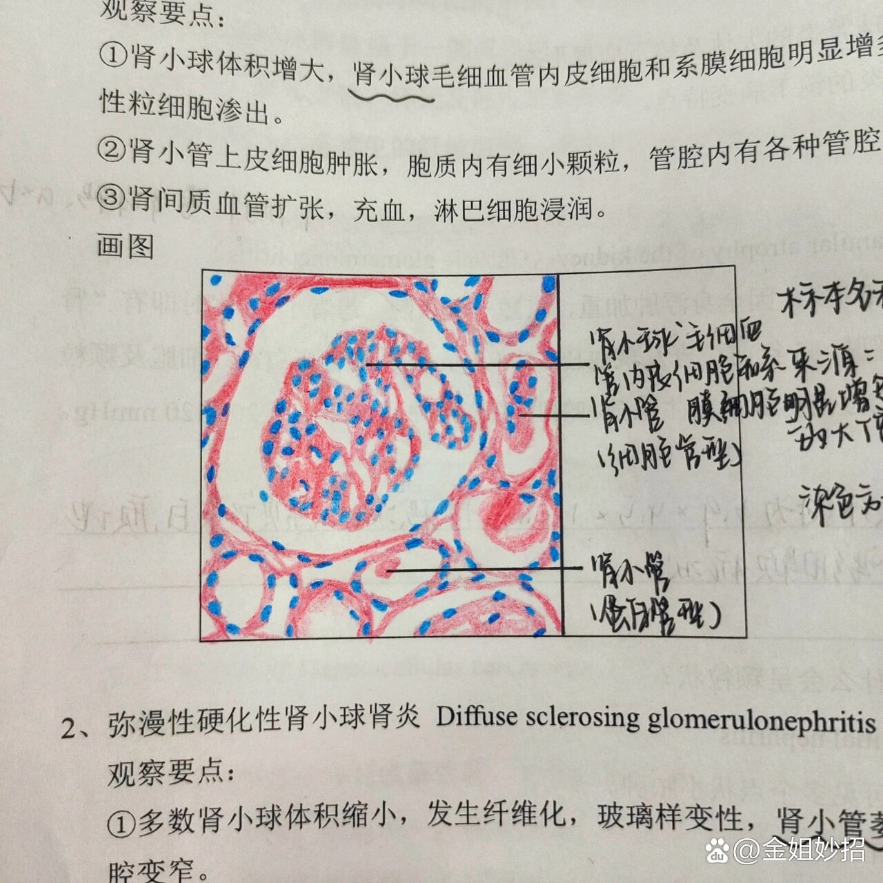 肾皮质迷路局部示意图图片