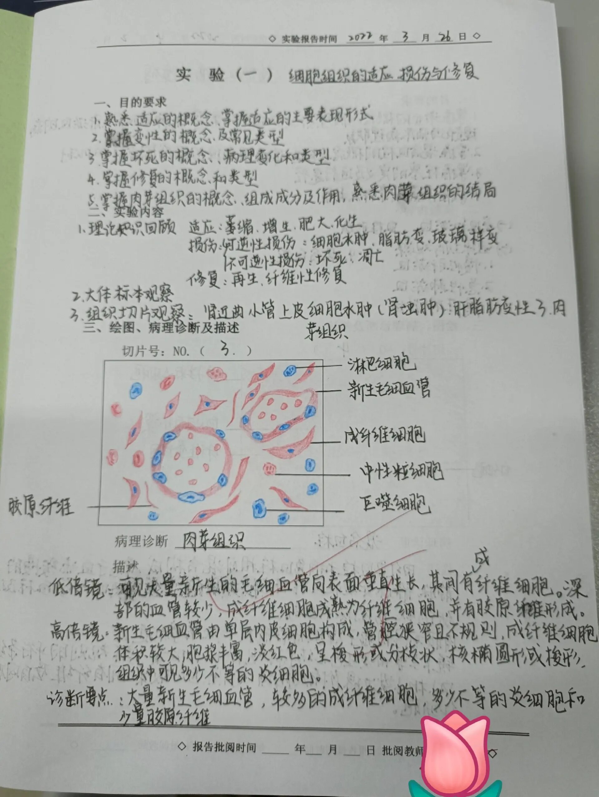 鼻息肉绘图红蓝铅笔图片