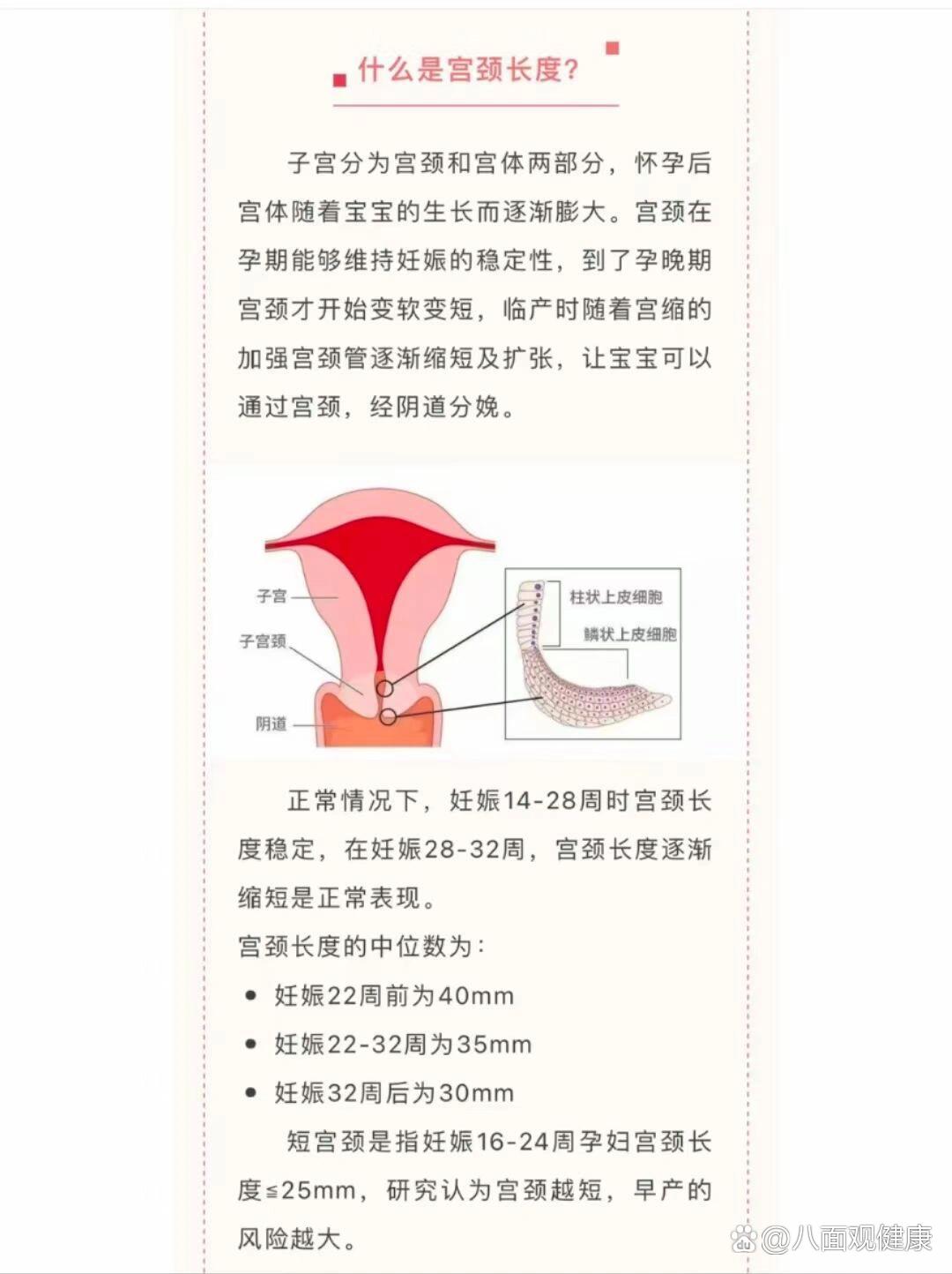 宫颈长度图片图片