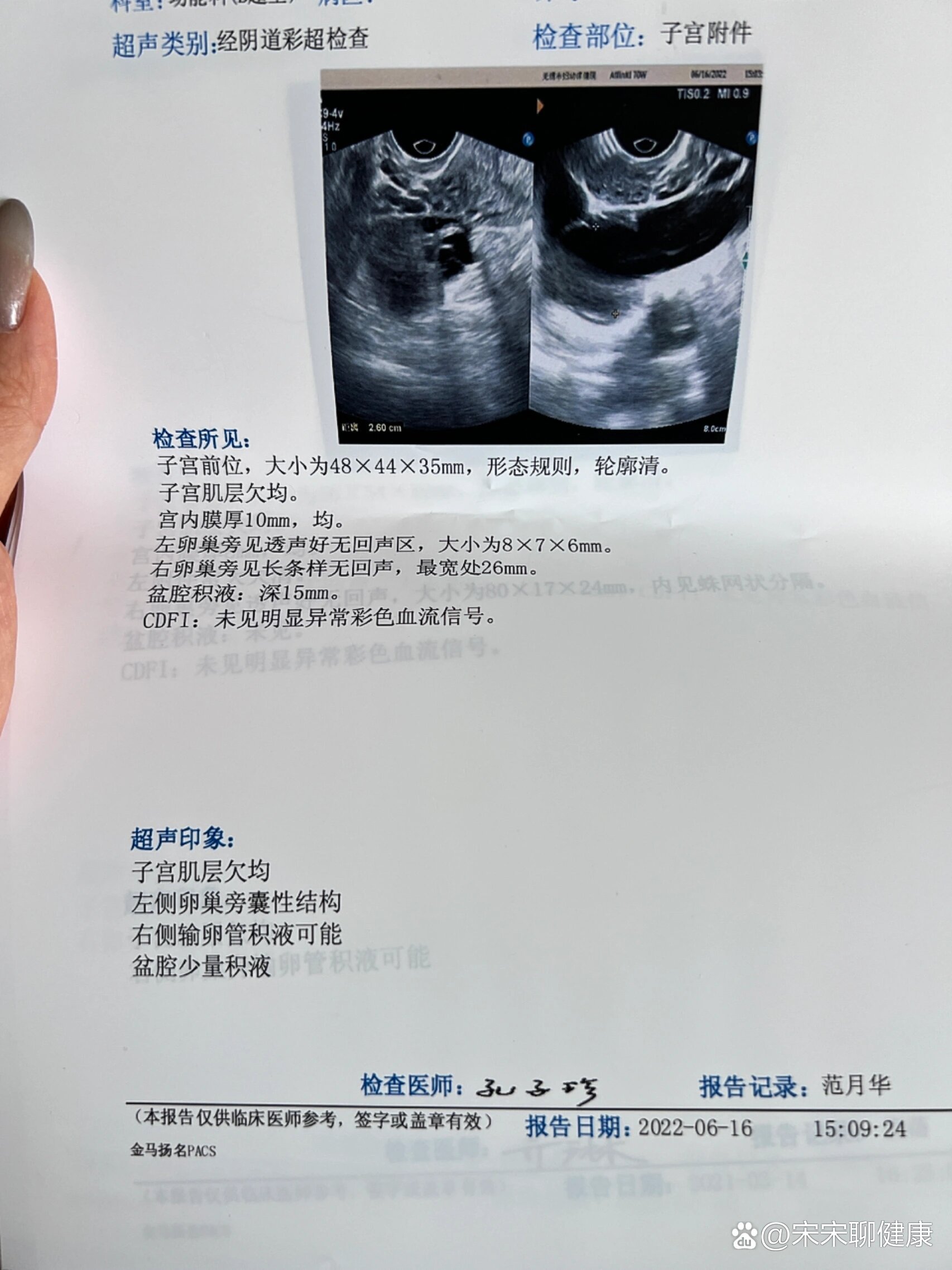 输卵管积水