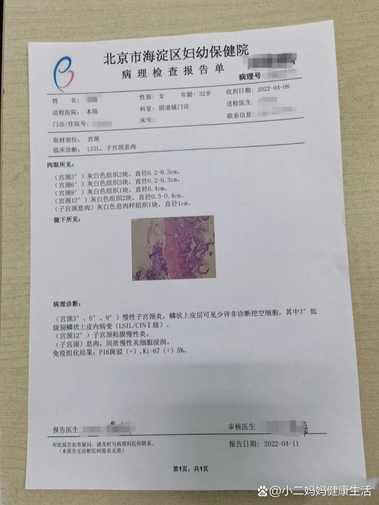 宫颈活检结果来了