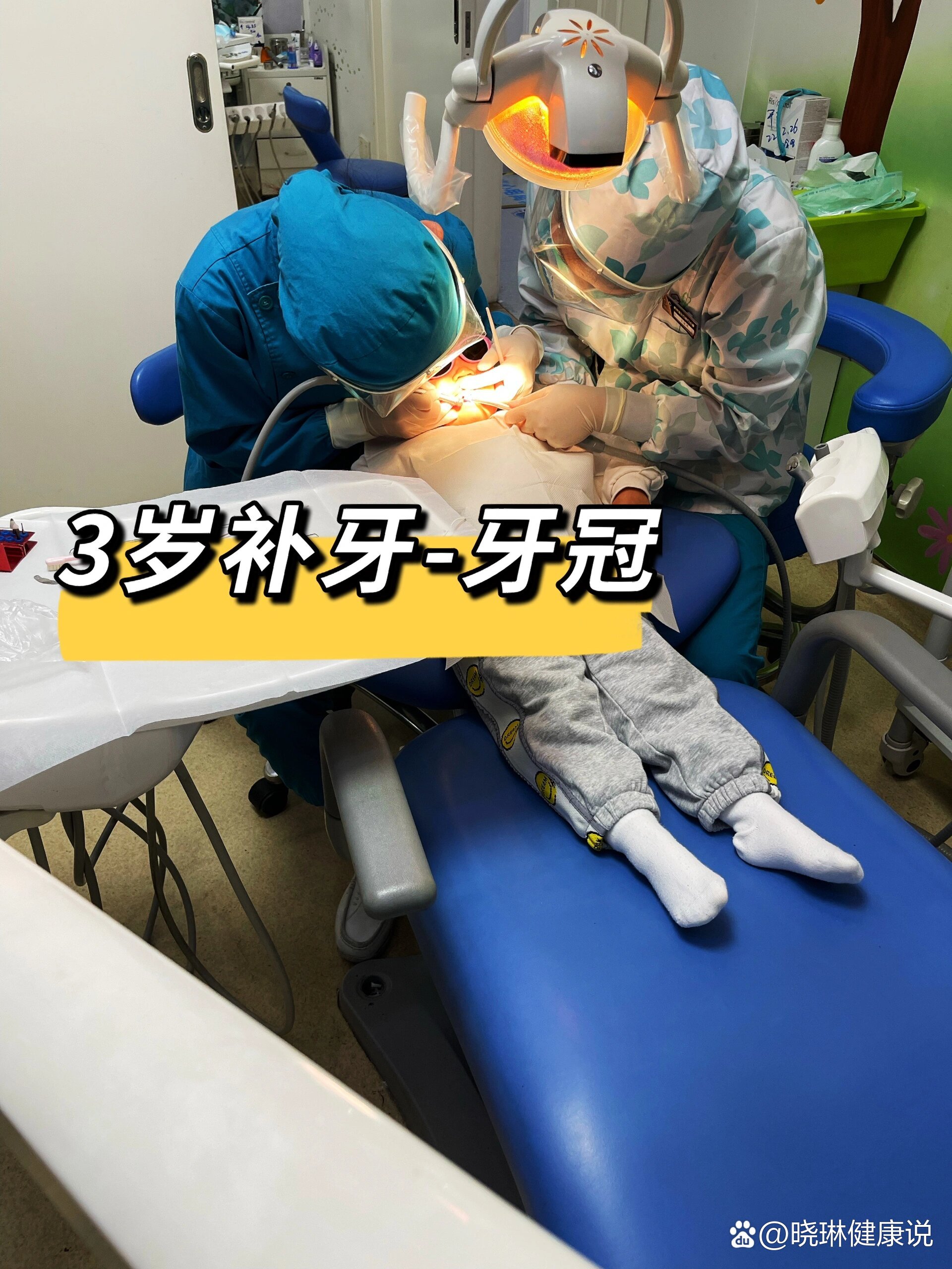 3岁宝宝蛀牙补牙记-牙冠篇