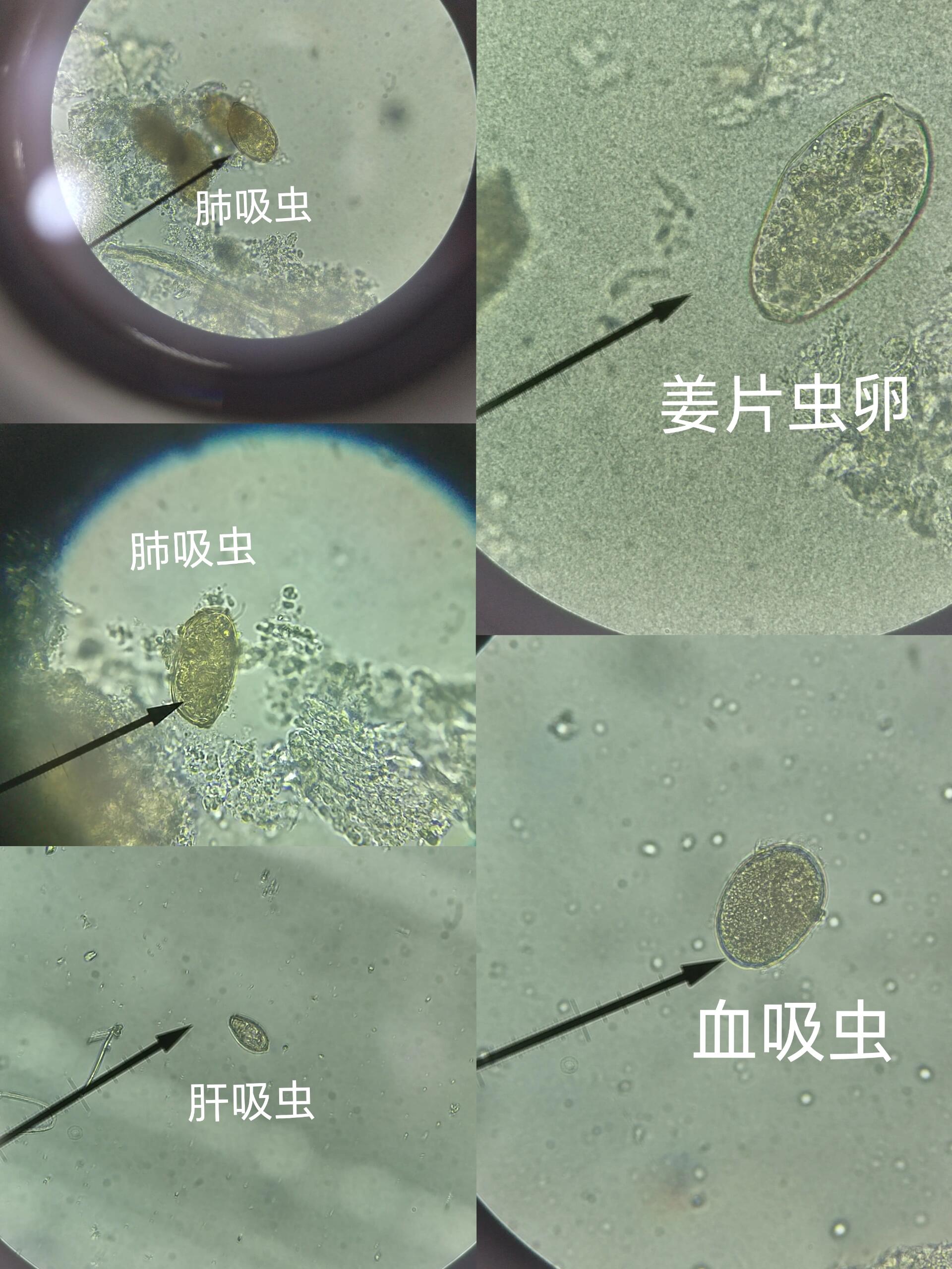 蛔虫卵肉眼可见吗图片