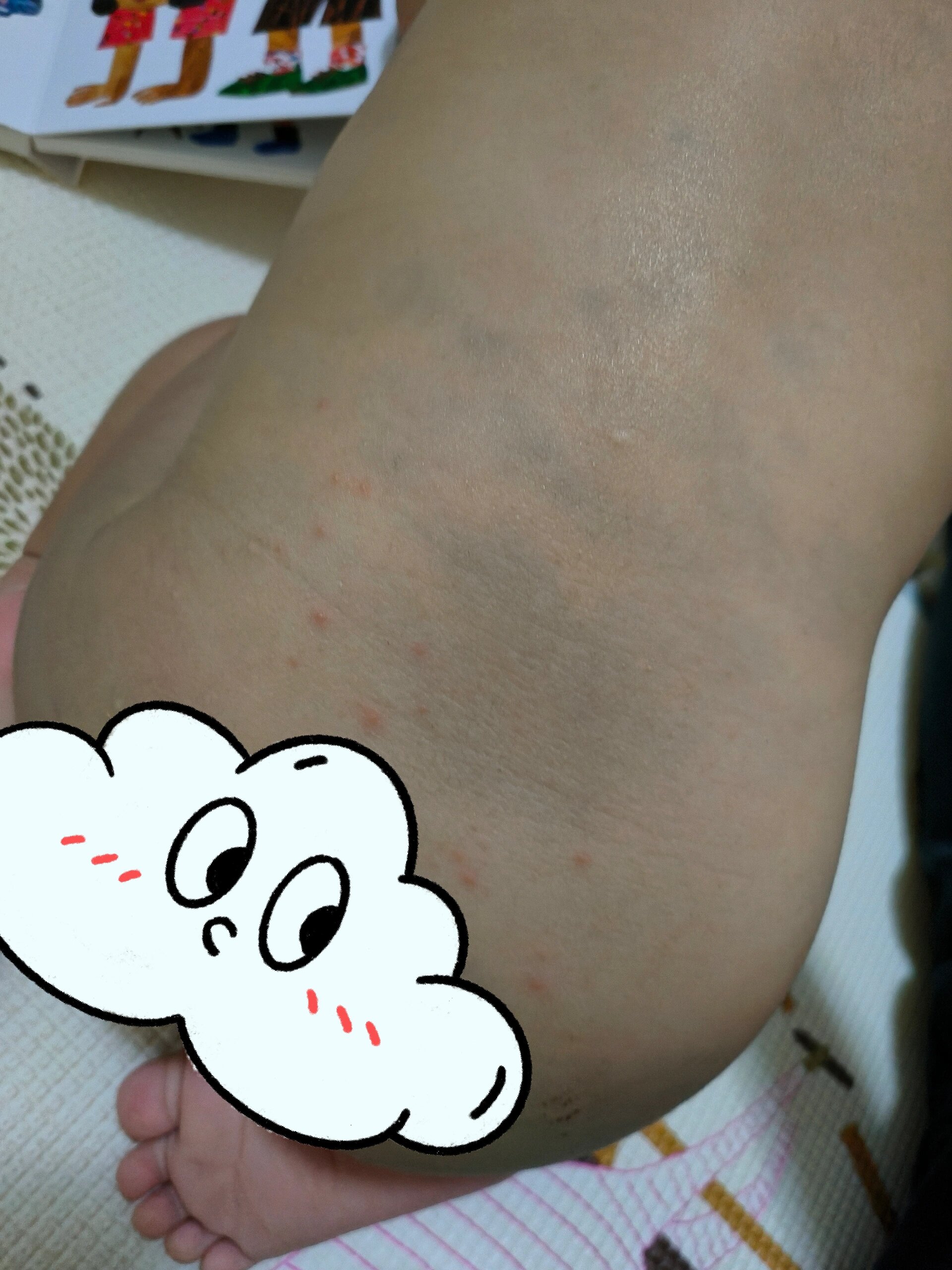 求问宝宝身上的红点是什么问题