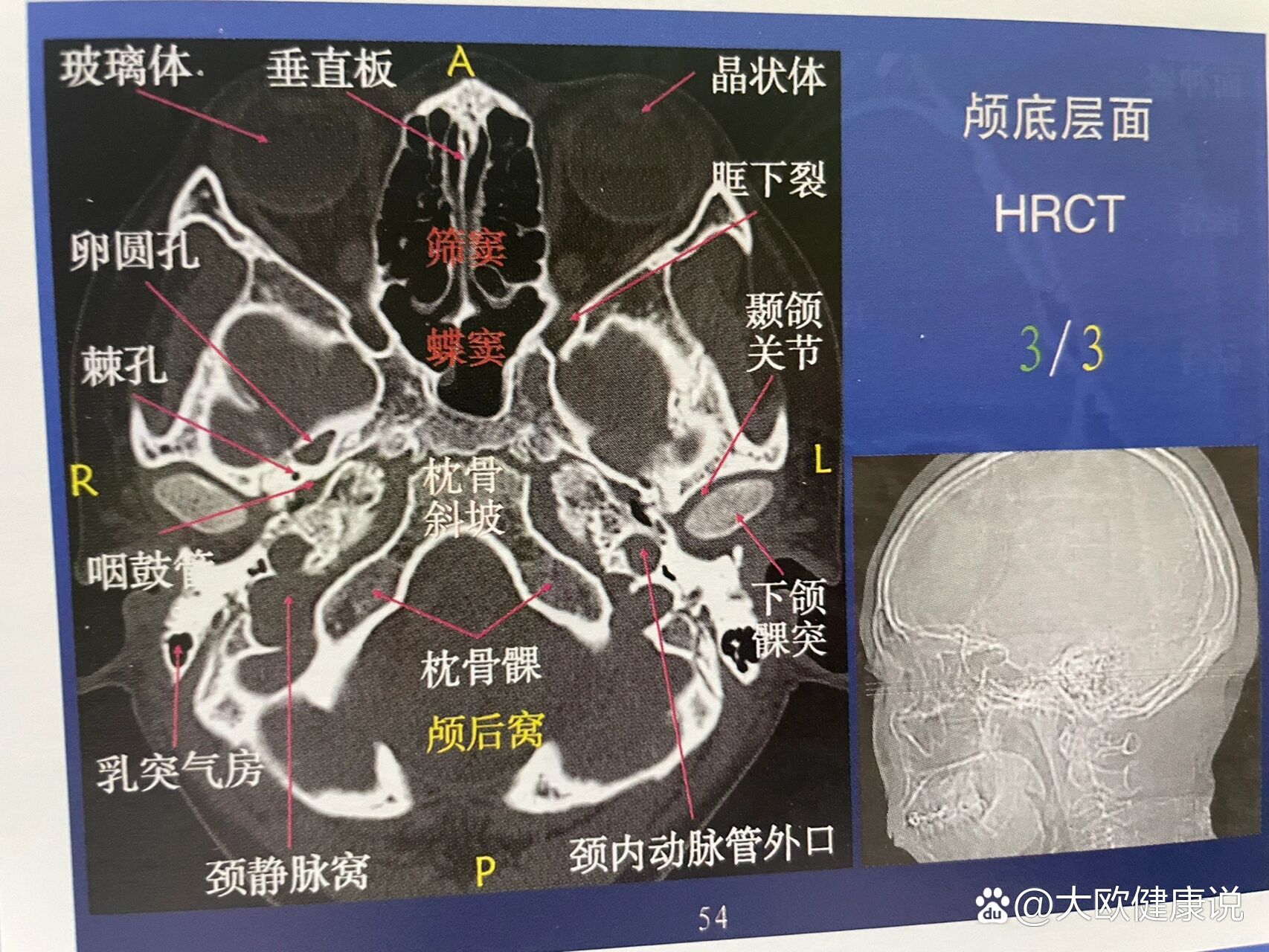 br>7815颅脑ct解剖口诀 br>一节一环 br>三体二囊 br>八池九