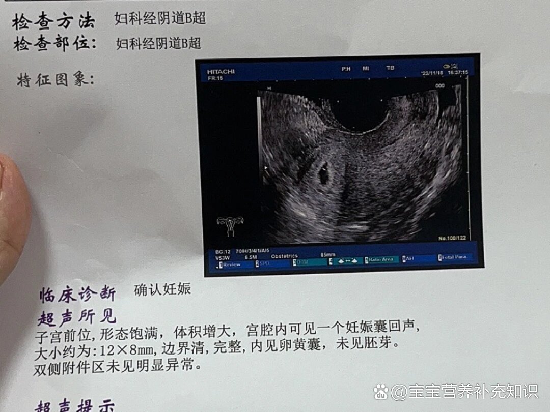 4周➕6天,阴超确定宫内好孕啦