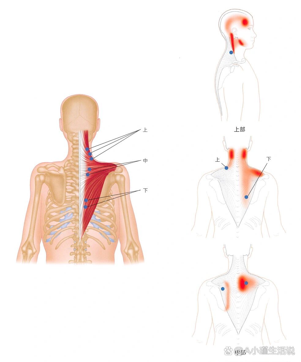 颈部斜方肌位置图图片
