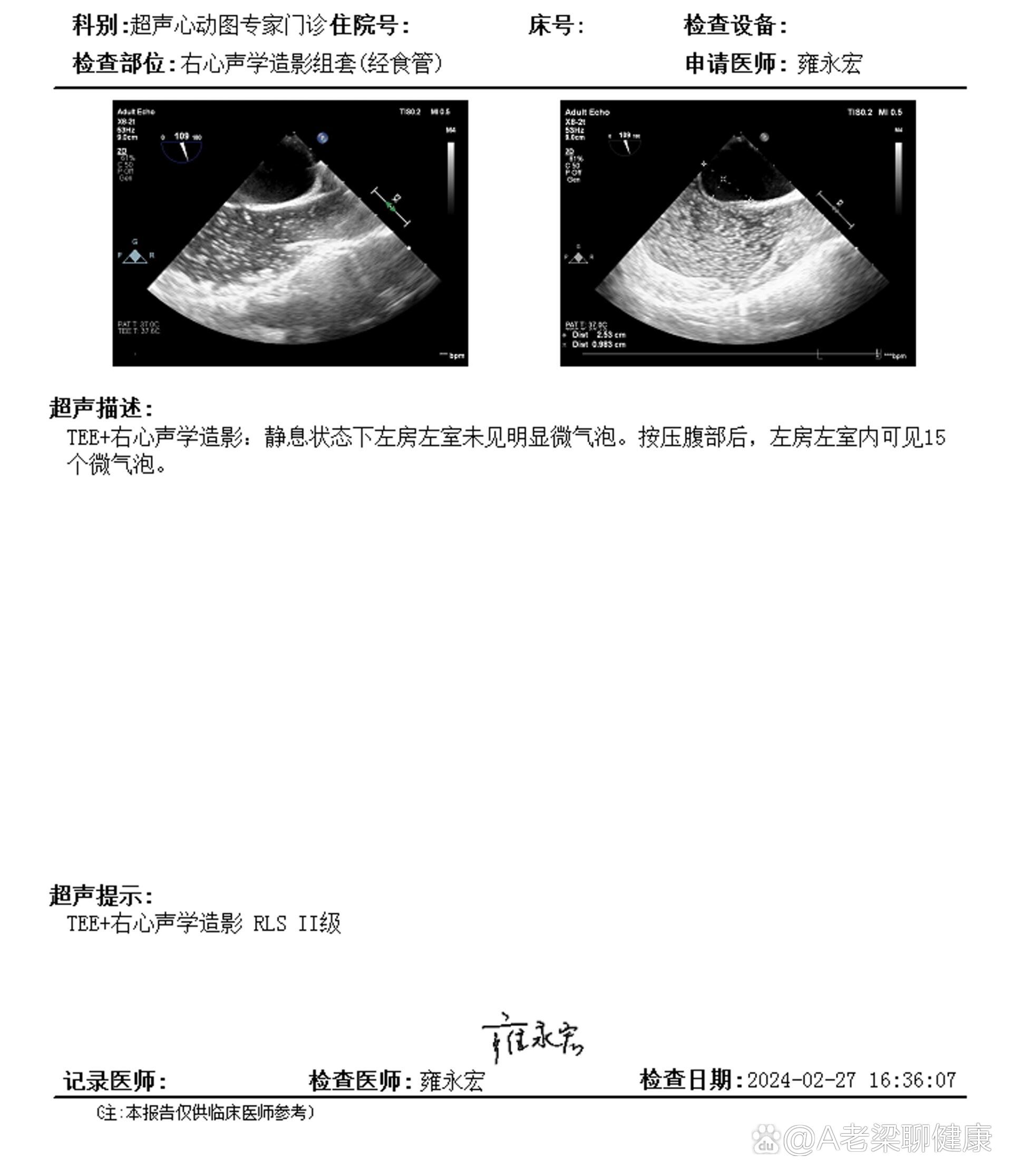 经食道心脏超声图片