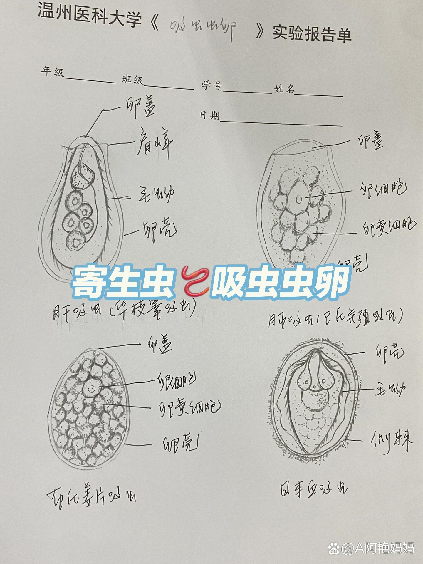 布氏姜片吸虫虫卵手绘图片