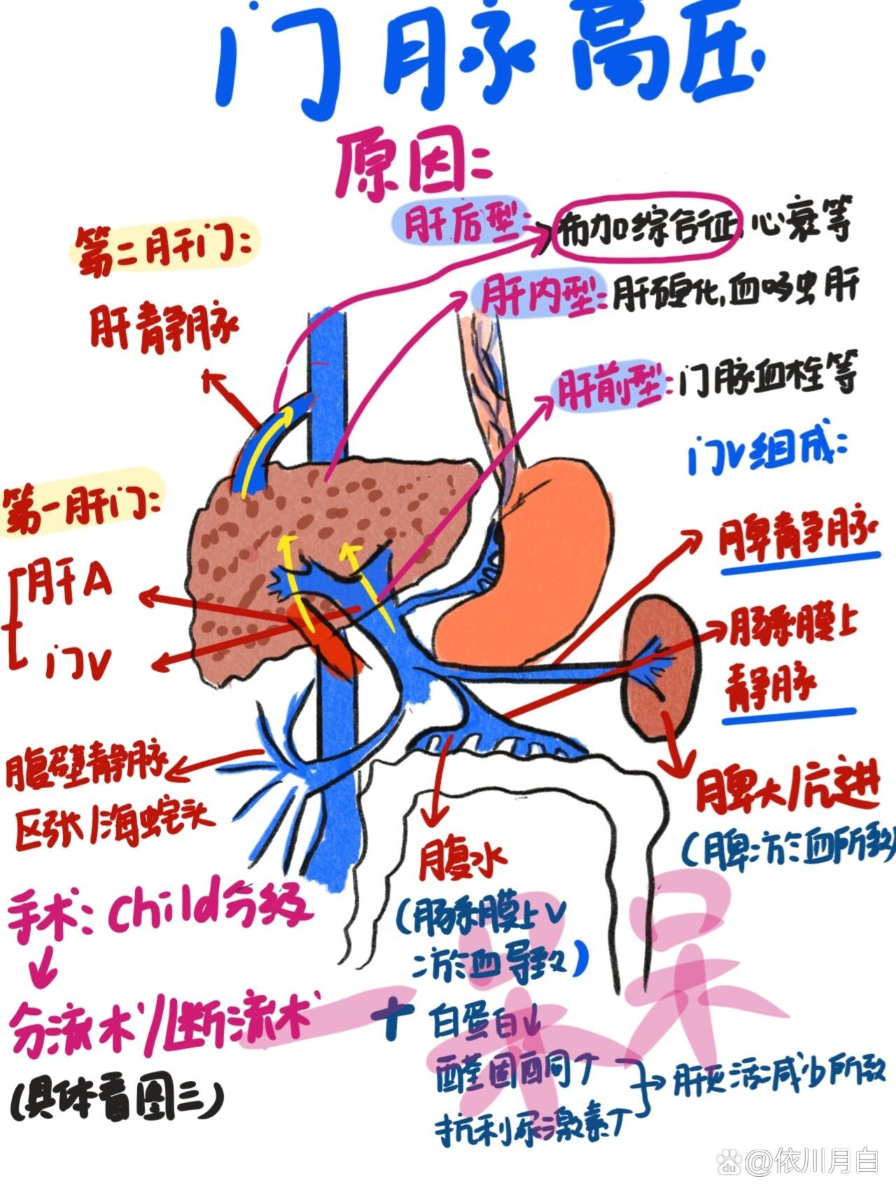 门静脉高压图解图片