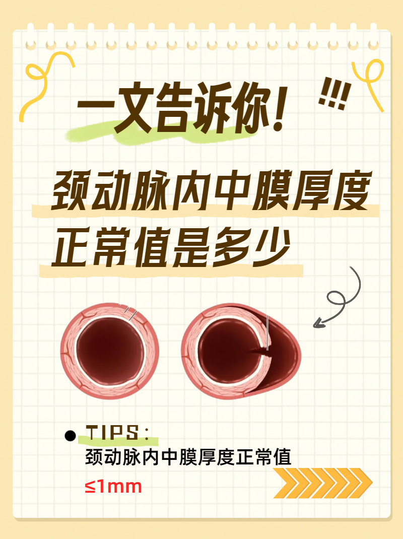 一文告诉你!颈动脉内中膜厚度正常值是多少