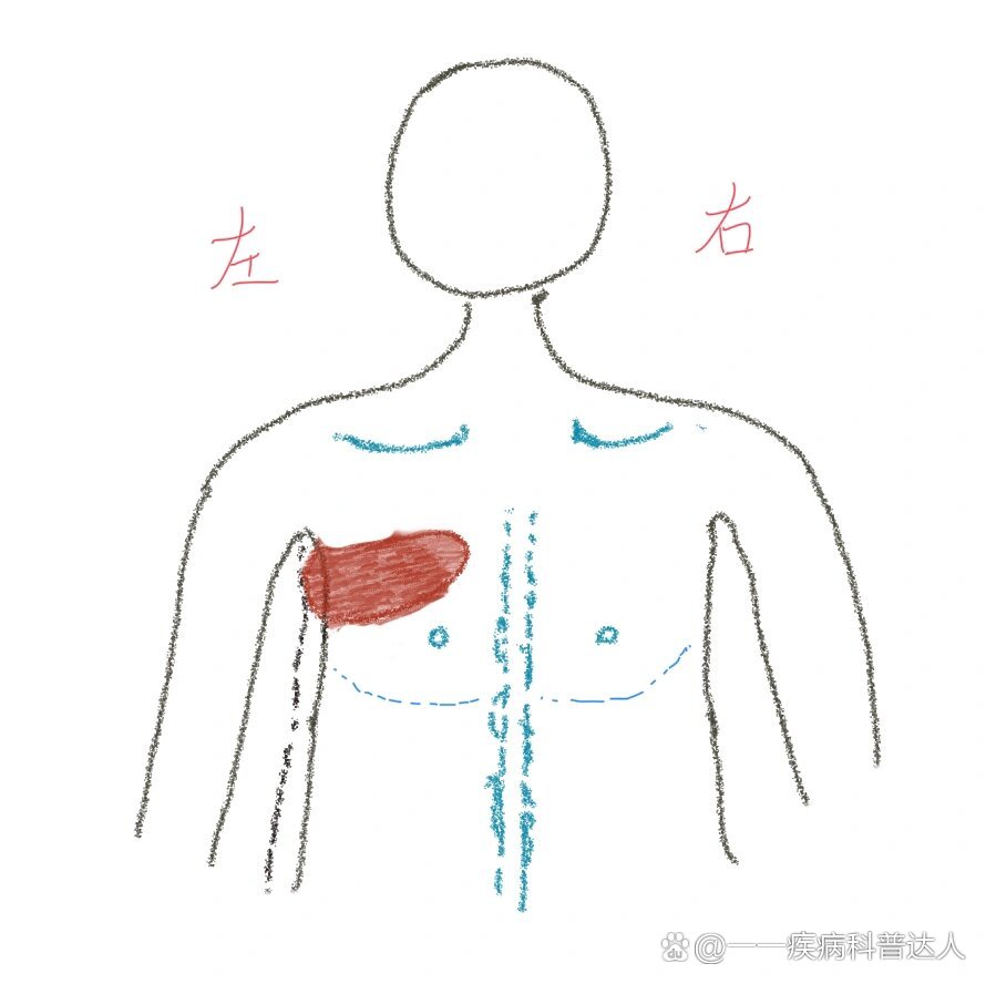 左胸及腋下肉疼