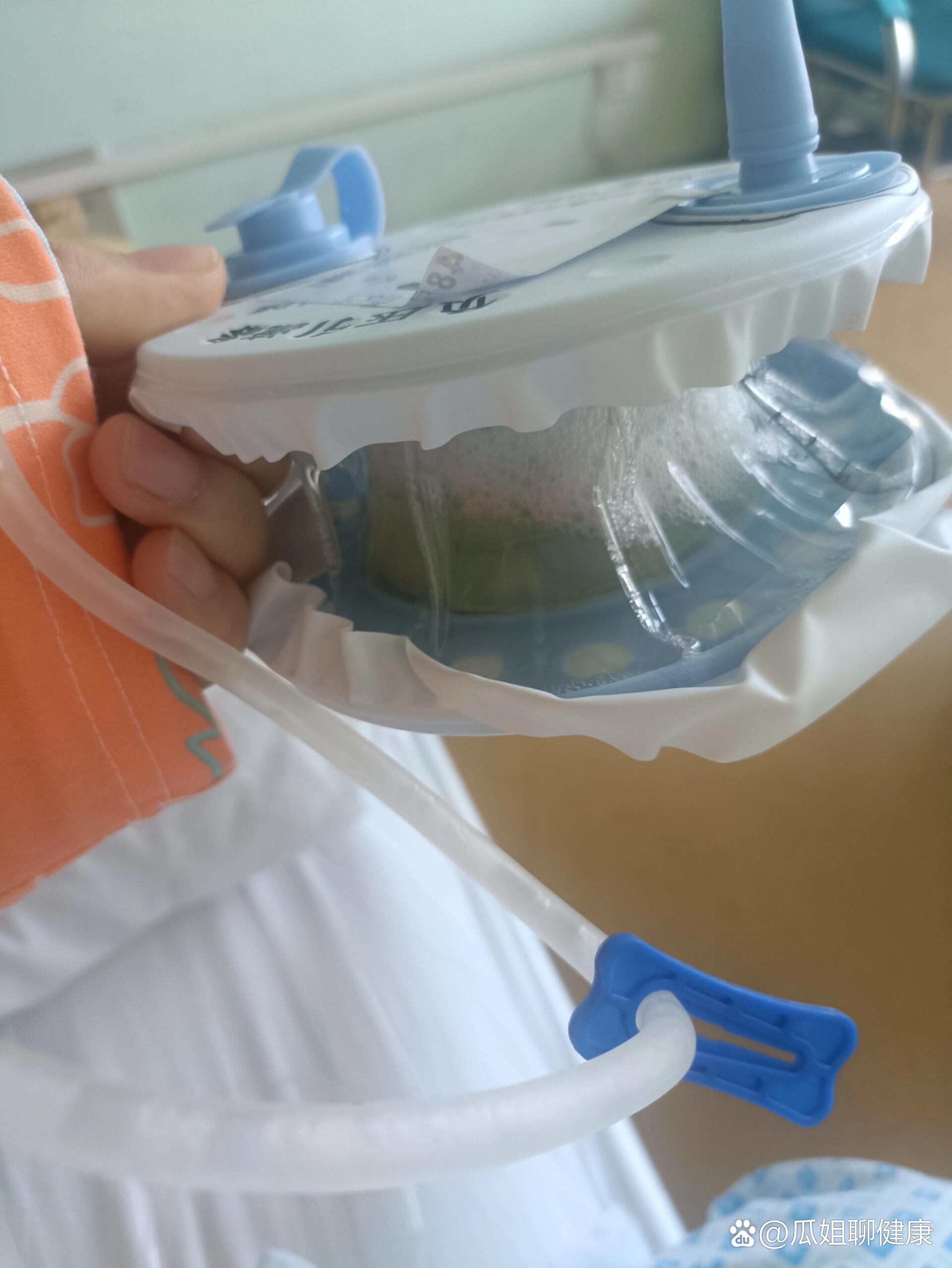 让人又爱又恨的胃管