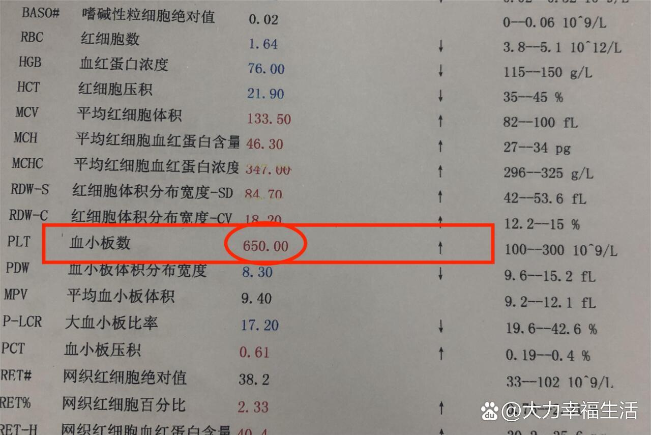 大血小板数目图片