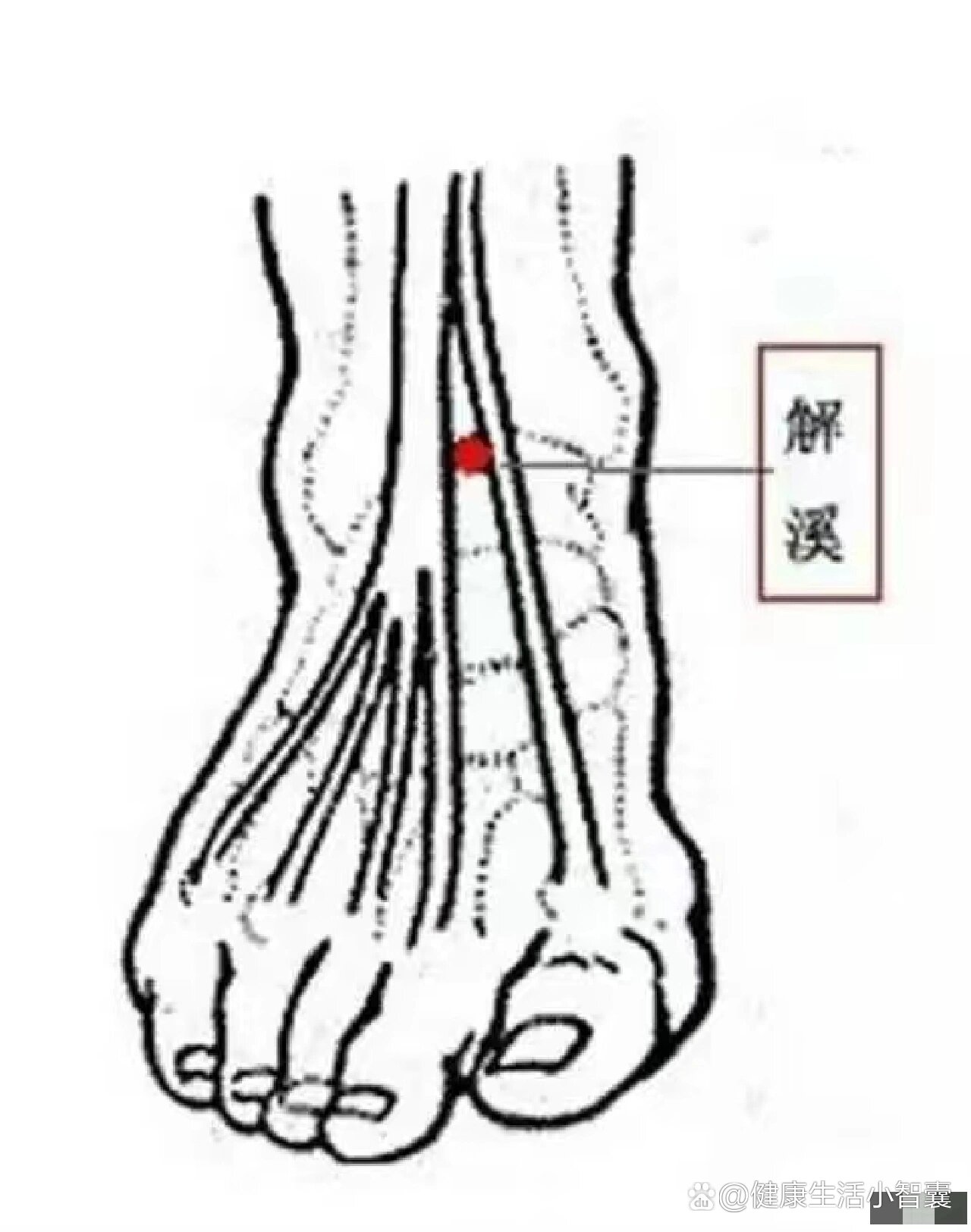 解溪针刺图片