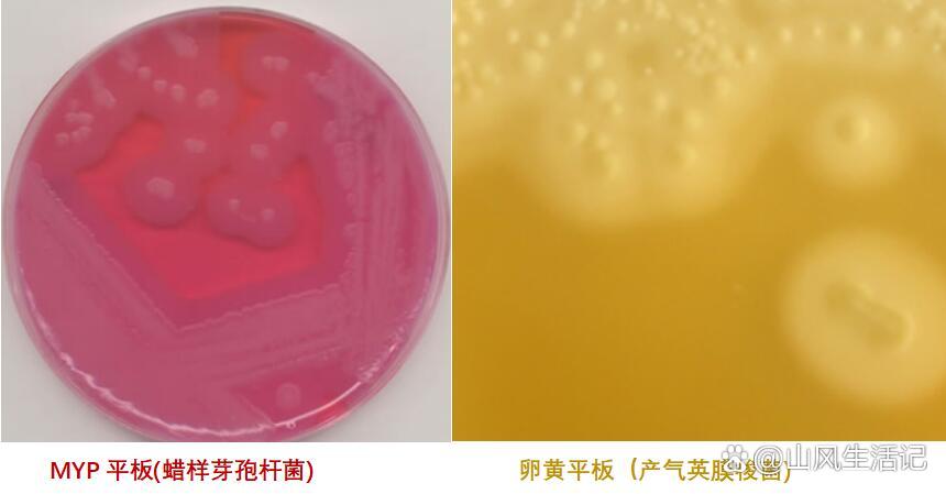 卵黄的作用及使用注意事项-化验员证书培训