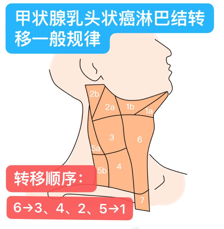 甲状腺分区图图片