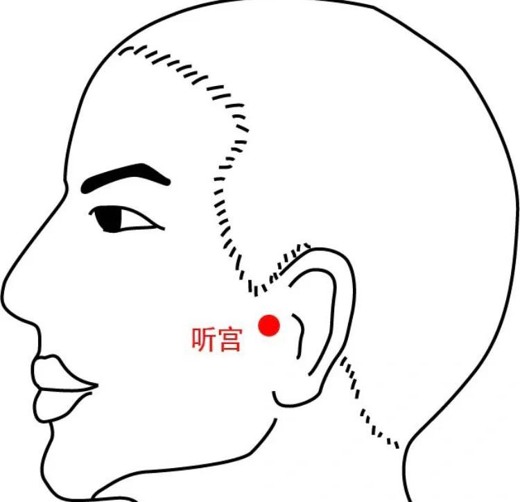 每日一穴：听宫穴，聪耳开窍的秘诀