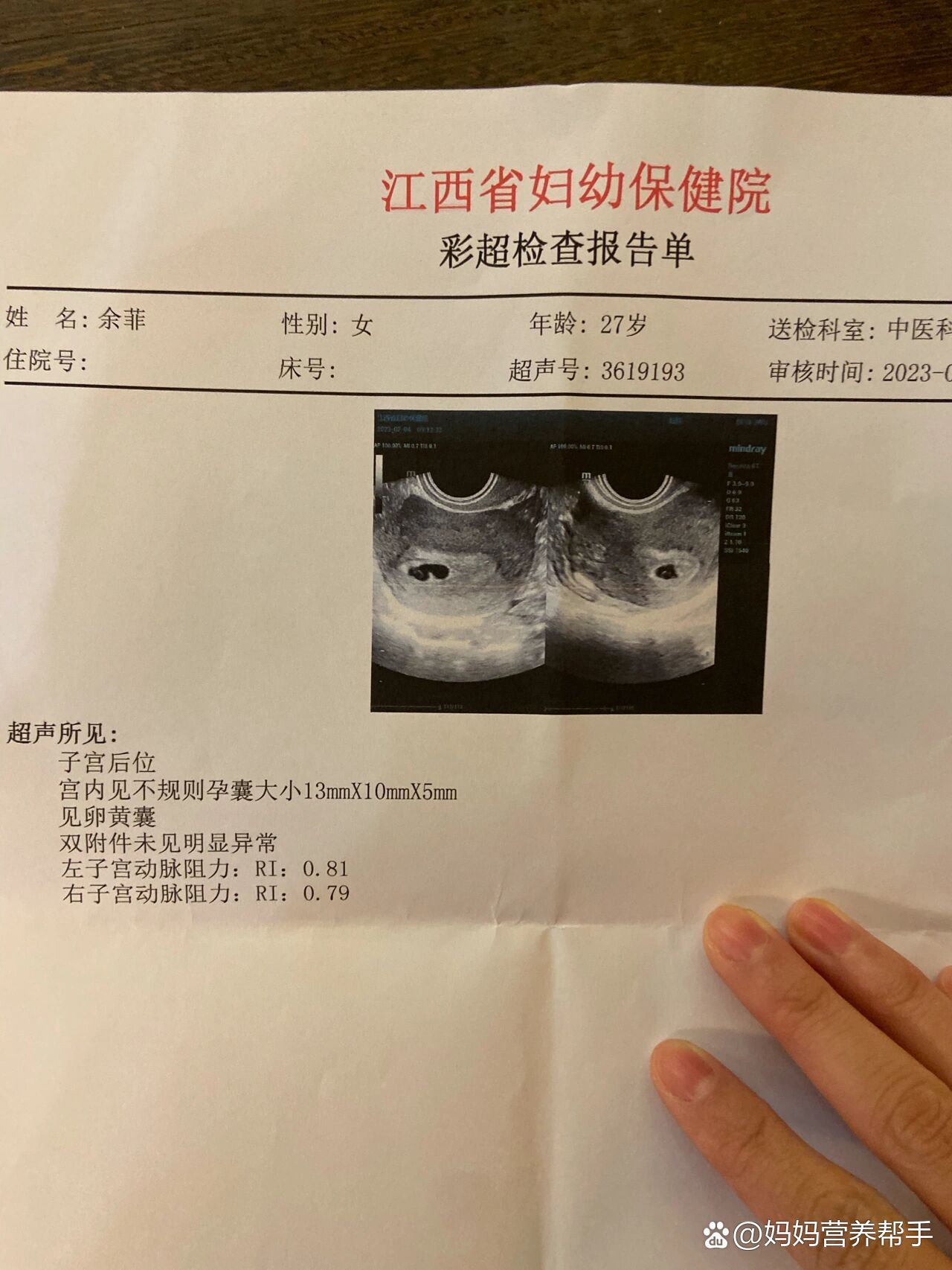 这个孕囊也太不规则了吧