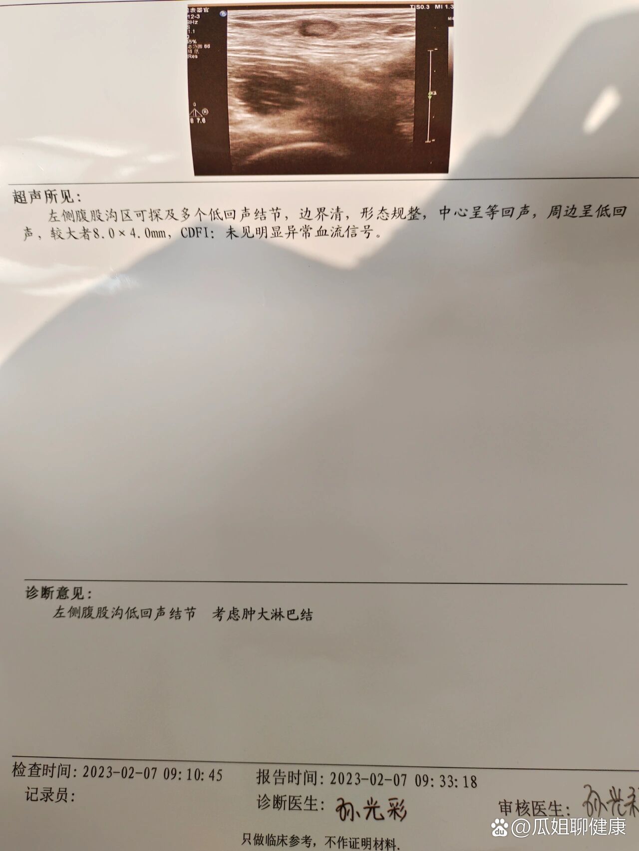 左侧腹股沟淋巴结肿大