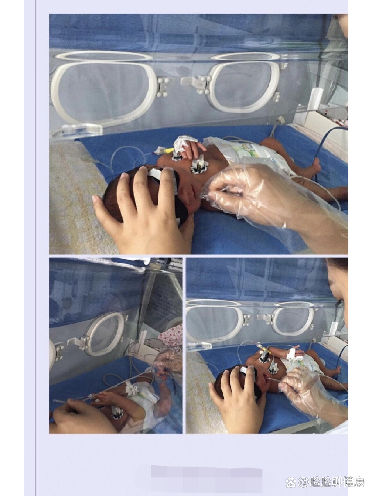 新生儿吞羊水呕吐要洗胃承受得了吗?