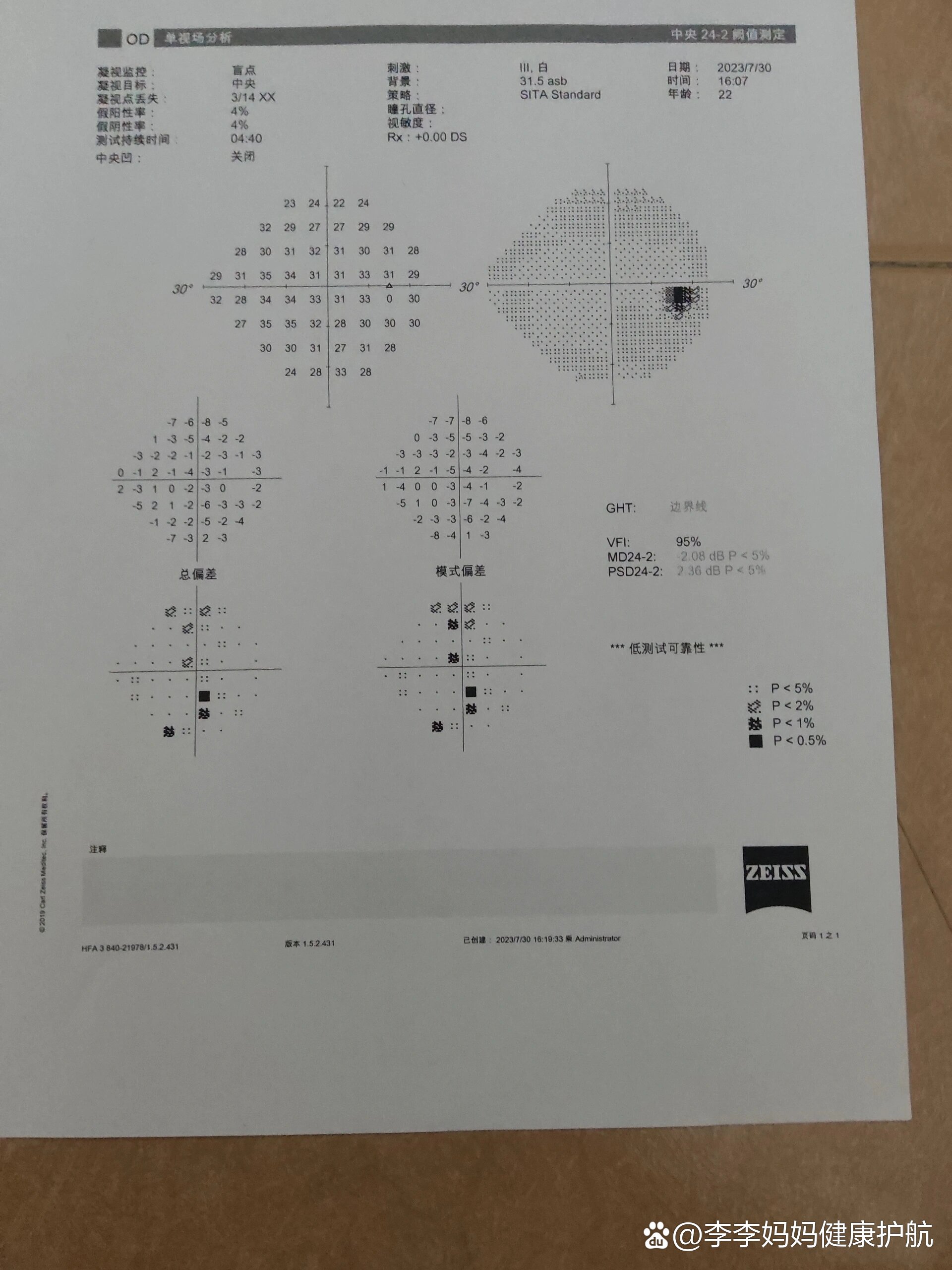 视野检查正常范围是多少