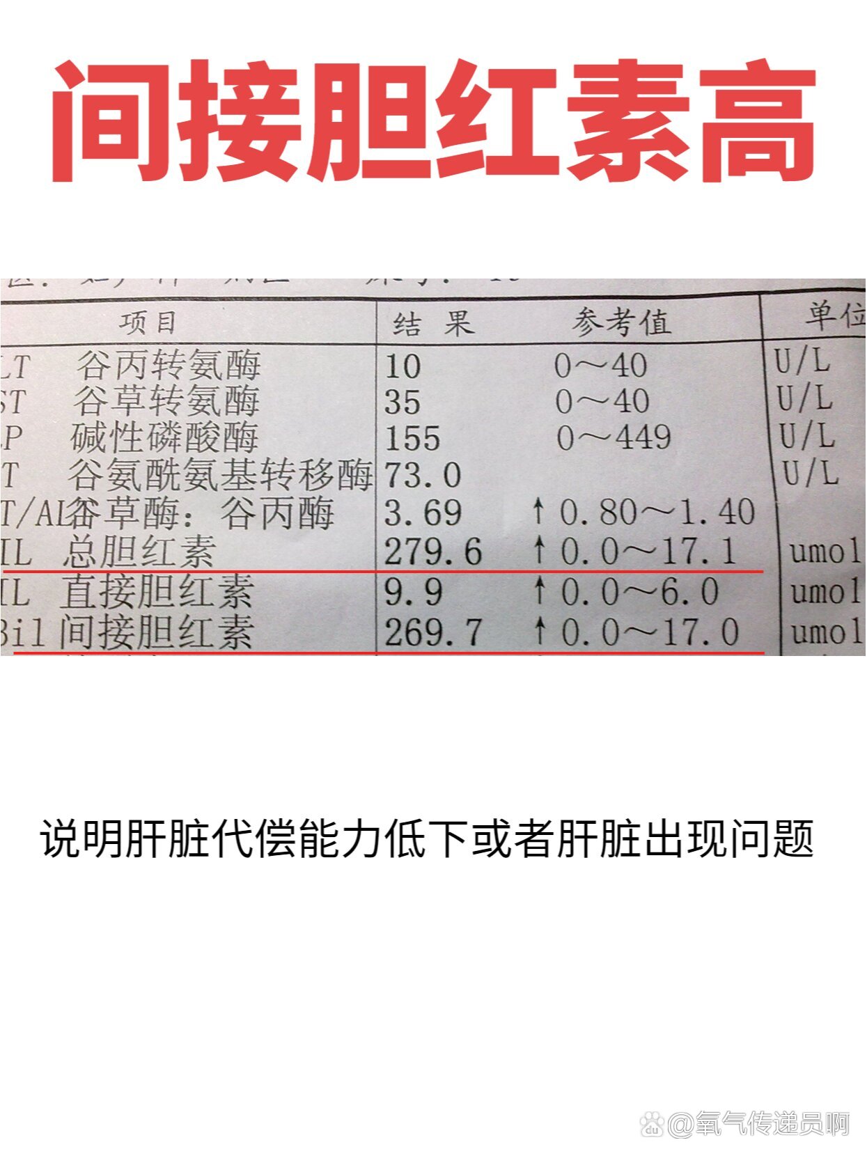 间接胆红素高说明什么