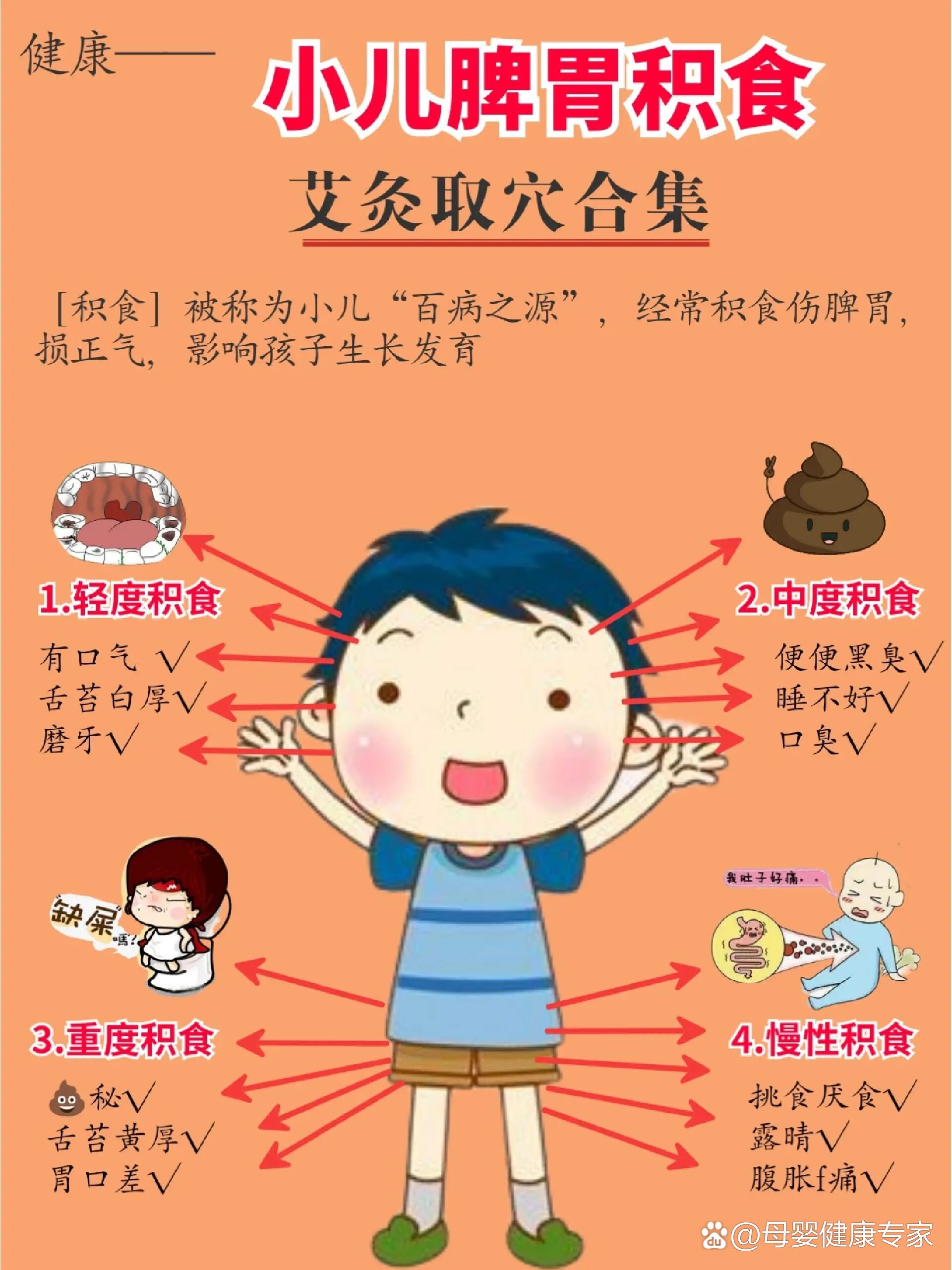 小孩肠胃炎艾灸示意图图片