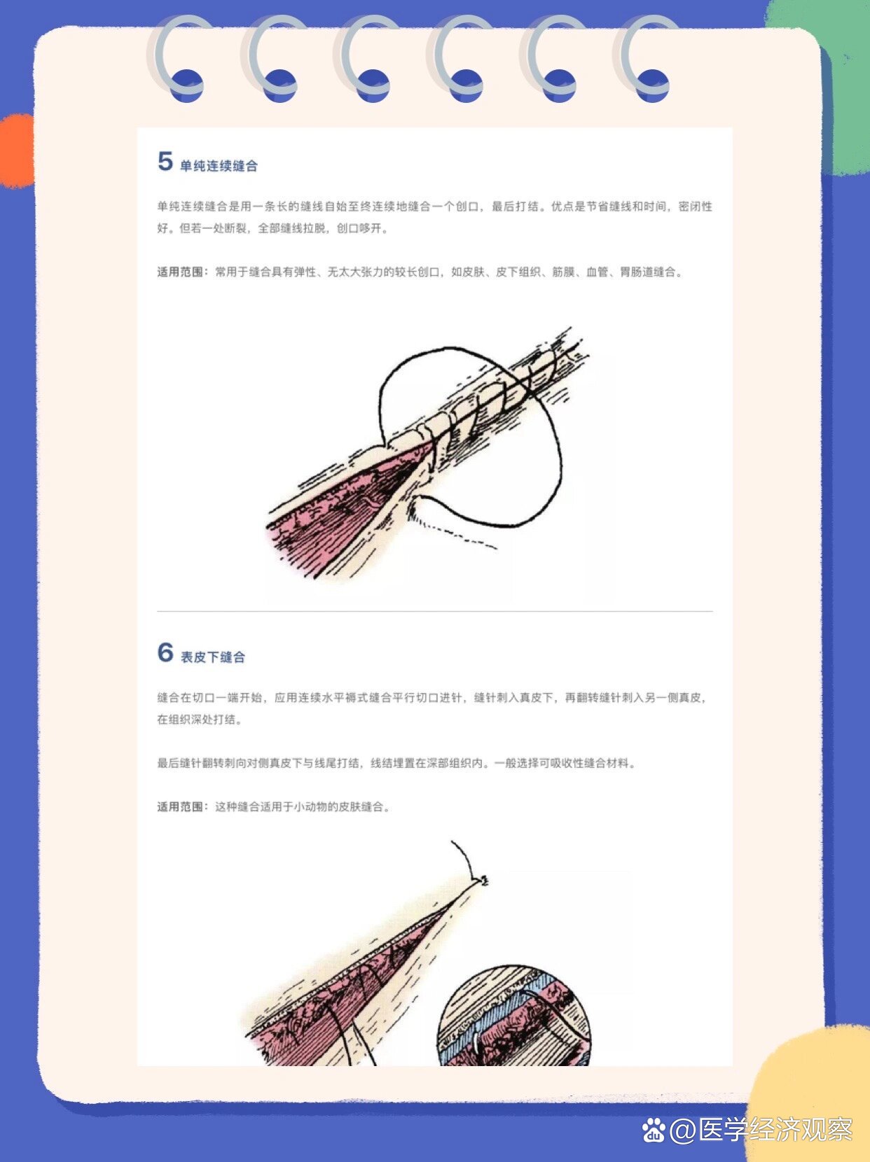 13种外科缝合方法