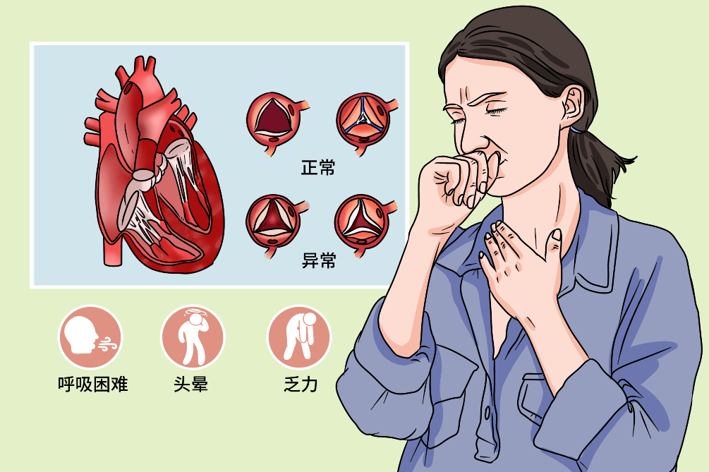 心脏换瓣膜是微创还是开刀