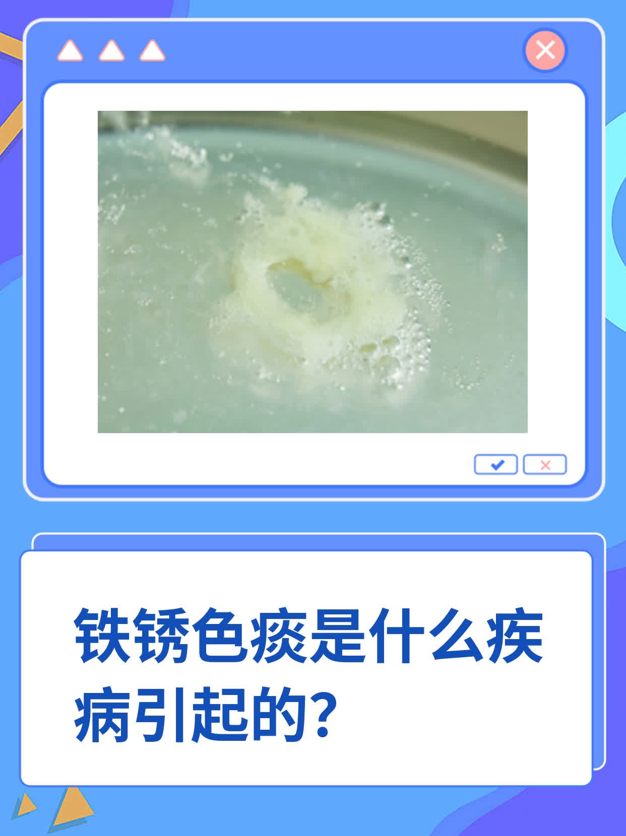 铁锈色痰是什么疾病引起的
