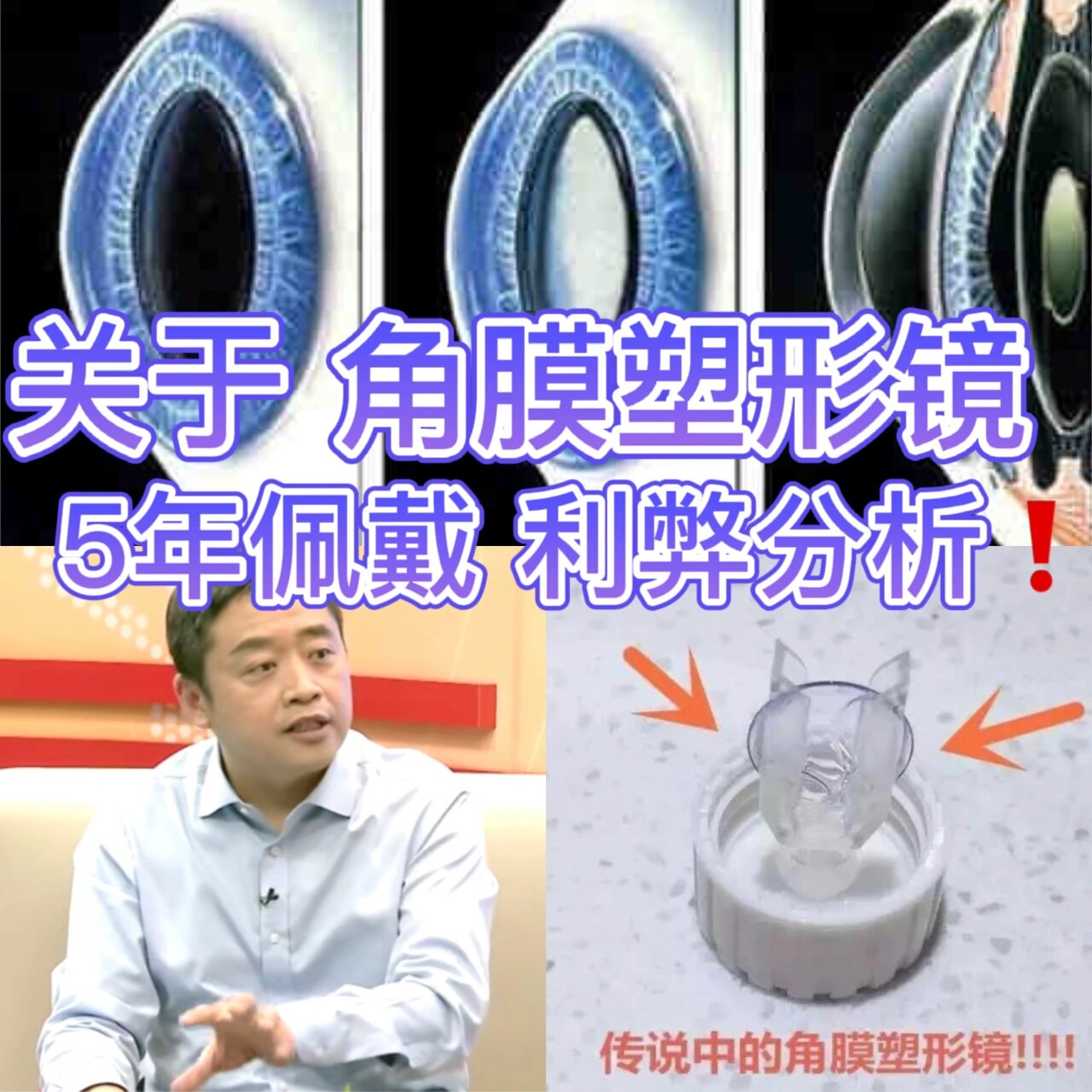 ok镜真的能治疗近视么?